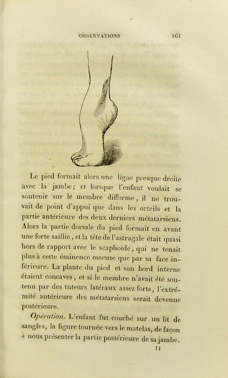 Le pied formait alors une ligne presque droite avec la jambe; et lorsque l'enfant voulait se soutenir sur le membre difforme, il ne trou- vait de point d'appui que dans les orteils et la partie antérieure des deux derniers métatarsiens. Alors la partie dorsale du pied formait en avant une forte saillie, et la tête de l'astragale était quasi hors de rapport avec le scaphoïde, qui ne tenait plus à cette éminence osseuse que par sa face in- férieure. La plante du pied et son bord interne étaient concaves, et si le membre n'avait été sou- tenu par des tuteurs latéraux assez forts, l'extré- mité antérieure des métatarsiens serait devenue postérieure. Opération. L'enfant fut couché sur un lit de sangles, la fignre tournée vers le matelas, de façon à nous présenter la partie postérieure de sa jambe. il
