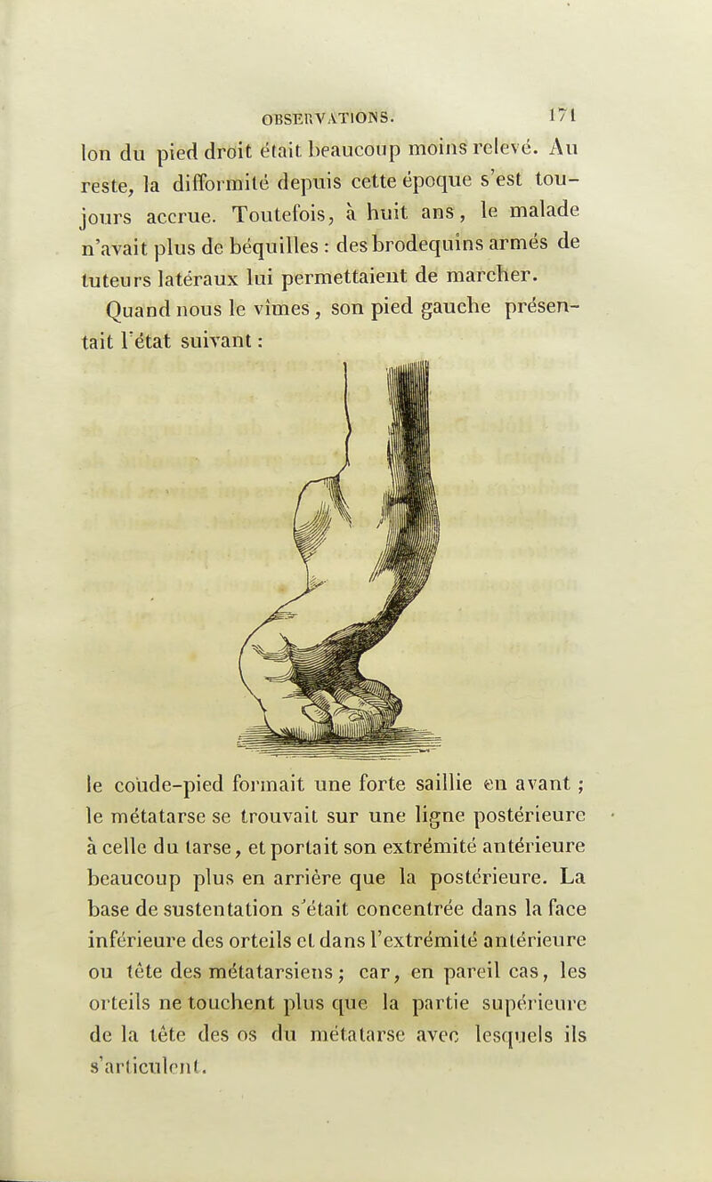 Ion du pied droit était beaucoup moins relevé. Au reste, la difformité depuis cette époque s'est tou- jours accrue. Toutefois, à huit ans, le malade n'avait plus de béquilles : des brodequins armés de tuteurs latéraux lui permettaient de marcher. Quand nous le vîmes, son pied gauche présen- tait l'état suivant : le coude-pied formait une forte saillie en avant ; le métatarse se trouvait sur une ligne postérieure à celle du tarse, et portait son extrémité antérieure beaucoup plus en arrière que la postérieure. La base de sustentation s'était concentrée dans la face inférieure des orteils et dans l'extrémité antérieure ou tête des métatarsiens ; car, en pareil cas, les orteils ne touchent plus que la partie supérieure de la tête des os du métatarse avec lesquels ils s'articulent.