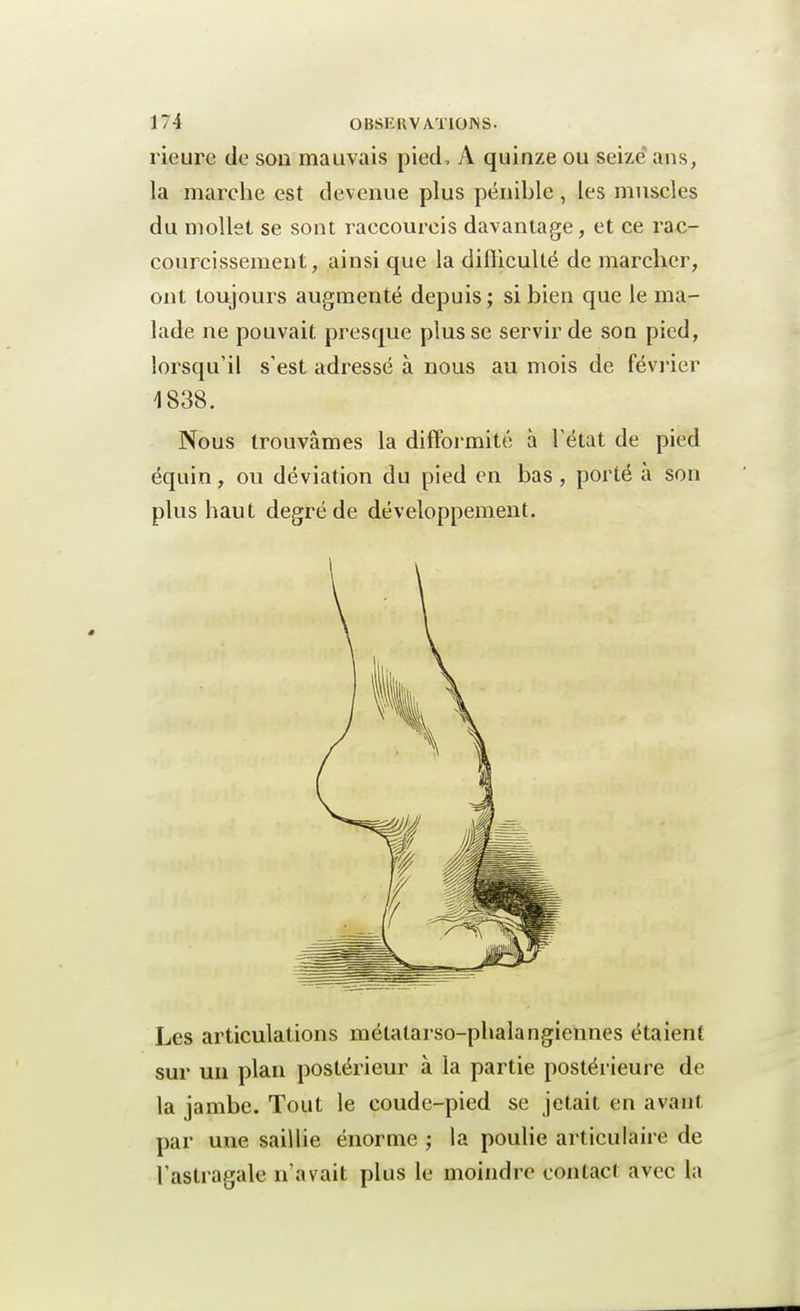 rieure de son mauvais pied, A quinze ou seize ans, la marche est devenue plus pénible, les muscles du mollet se sont raccourcis davantage, et ce rac- courcissement, ainsi que la difficulté de marcher, ont toujours augmenté depuis; si bien que le ma- lade ne pouvait presque plus se servir de son pied, lorsqu'il s'est adressé à nous au mois de février 1838. Nous trouvâmes la difformité à l'état de pied équin, ou déviation du pied en bas, porté à son plus haut degré de développement. Les articulations métalarso-phalangiennes étaient sur un plan postérieur à la partie postérieure de la jambe. Tout le coude-pied se jetait en avant par une saillie énorme ; la poulie articulaire de l'astragale n'avait plus le moindre contact avec la
