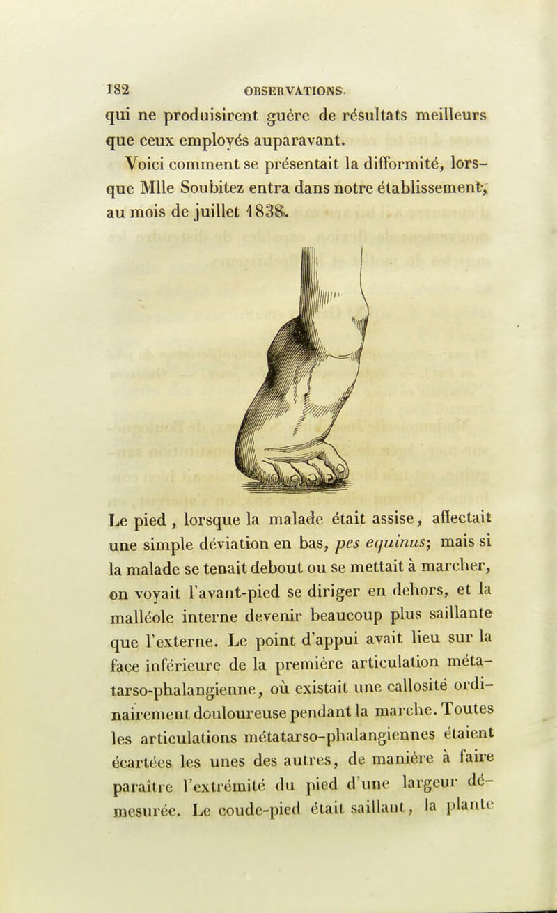 qui ne produisirent guère de résultats meilleurs que ceux employés auparavant. Voici comment se présentait la difformité, lors- que Mlle Soubitez entra dans notre établissement', au mois de juillet 1838. Le pied , lorsque la malade était assise, affectait une simple déviation en bas, pes equinus; mais si la malade se tenait debout ou se mettait à marcher, on voyait lavant-pied se diriger en dehors, et la malléole interne devenir beaucoup plus saillante que l'externe. Le point d'appui avait lieu sur la face inférieure de la première articulation méta- tarso-phalangienne, où existait une callosité ordi- nairement douloureuse pendant la marche. Toutes les articulations métatarso-phalangiennes étaient écartées les unes des autres, de manière à faire paraître l'extrémité du pied d'une largeur dé- mesurée. Le coude-pied était saillant, la plante