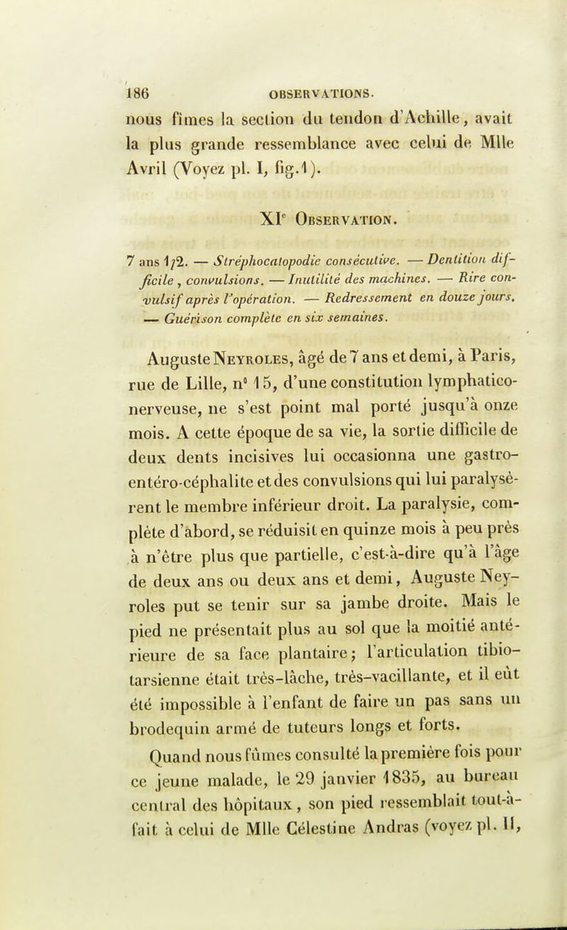 nous finies la section du tendon d'Achille, avait la plus grande ressemblance avec celui de Mlle Avril (Voyez pl. I, fig.1). XI0 Observation. 7 ans 1/2. — Stréphocatopodie consécutive. — Dentition dif- ficile , convulsions. — Inutilité des machines. — Rire con- vulsif après l'opération. — Redressement en douze jours. — Guérison complète en six semaines. Auguste Neyroles, âgé de 7 ans et demi, à Paris, rue de Lille, n° 15, d'une constitution lymphatico- nerveuse, ne s'est point mal porté jusqu'à onze mois. A cette époque de sa vie, la sortie difficile de deux dents incisives lui occasionna une gastro- entéro-céphalite et des convulsions qui lui paralysè- rent le membre inférieur droit. La paralysie, com- plète d'abord, se réduisit en quinze mois à peu près à n'être plus que partielle, c'est-à-dire qu'à l'âge de deux ans ou deux ans et demi, Auguste Ney- roles put se tenir sur sa jambe droite. Mais le pied ne présentait plus au sol que la moitié anté- rieure de sa face plantaire; l'articulation tibio- tarsienne était très-lâche, très-vacillante, et il eût été impossible à l'enfant de faire un pas sans un brodequin armé de tuteurs longs et forts. Quand nous fûmes consulté la première fois pour ce jeune malade, le 29 janvier 1835, au bureau central des hôpitaux, son pied ressemblait tout-a- fait à celui de Mlle Célestine Andras (voyez pl. Il,