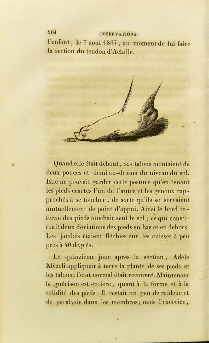 l'enfant, le 7 août 1837, au moment de lui faire la section du tendon d'Achille. Quand elle était debout, ses talons montaient de deux pouces et demi au-dessus du niveau du sol. Elle ne pouvait garder cette posture qu'en tenant les pieds écartés l'un de l'autre et les genoux rap- prochés à se toucher, de sorte qu'ils se servaient mutuellement de point d'appui. Ainsi le bord in- terne des pieds touchait seul le sol ; ce qui consti- tuait deux déviations des pieds en bas et en dehors. Les jambes étaient fléchies sur les cuisses à peu près à 40 degrés. Le quinzième jour après la section , Adèle Klézeli appliquait à terre la plante de ses pieds et les talons; l'état normal était recouvré. Maintenant la guérison est entière, quant à la forme et à la solidité des pieds- Il restait un peu de raideur et de paralysie dans les membres; mais l'exercice,