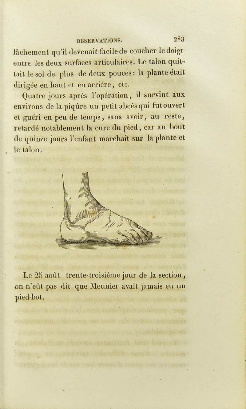 lâchement qu'il devenait facile de coucher le doigt entre les deux surfaces articulaires. Le talon quit- tait le sol de plus de deux pouces : la plante était dirigée en haut et en arrière, etc. Quatre jours après l'opération, il survint aux environs de la piqûre un petit abcès qui fut ouvert et guéri en peu de temps, sans avoir, au reste, retardé notablement la cure du pied, car au bout de quinze jours l'enfant marchait sur la plante et , le talon, Le 25 août trente-troisième jour de la section, on n'eût pas dit que Meunier avait jamais eu un pied-bot.