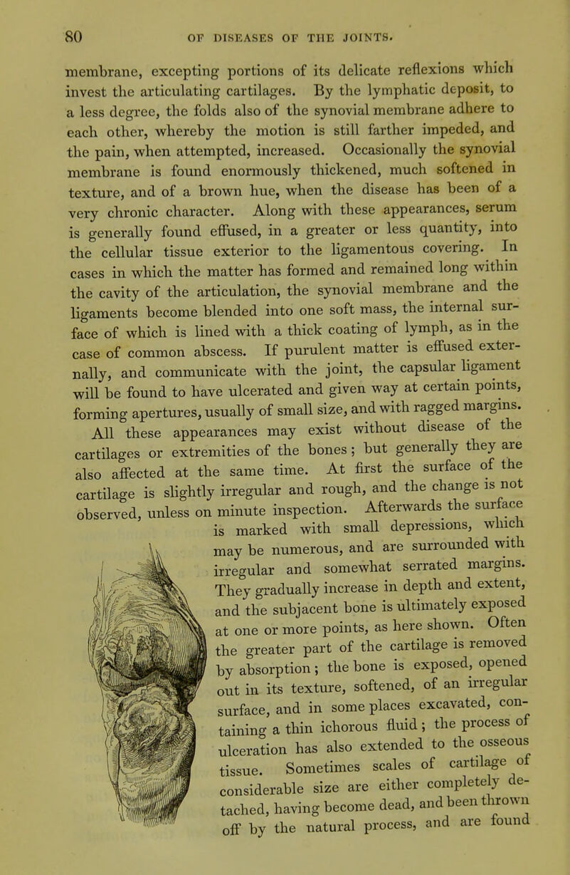 membrane, excepting portions of its delicate reflexions which invest the articulating cartilages. By the lymphatic deposit, to a less degree, the folds also of the synovial membrane adhere to each other, whereby the motion is still farther impeded, and the pain, when attempted, increased. Occasionally the synovial membrane is found enormously thickened, much softened in texture, and of a brown hue, when the disease has been of a very chronic character. Along with these appearances, serum is generally found effused, in a greater or less quantity, into the cellular tissue exterior to the ligamentous covering. In cases in which the matter has formed and remained long within the cavity of the articulation, the synovial membrane and the ligaments become blended into one soft mass, the internal sur- face of which is lined with a thick coating of lymph, as in the case of common abscess. If purulent matter is effused exter- nally, and communicate with the joint, the capsular ligament will be found to have ulcerated and given way at certain points, forming apertures, usually of small size, and with ragged margins. All these appearances may exist without disease of the cartilages or extremities of the bones ; but generally they are also affected at the same time. At first the surface of the cartilage is slightly irregular and rough, and the change is not observed, unless on minute inspection. Afterwards the surface is marked with small depressions, winch may be numerous, and are surrounded with irregular and somewhat serrated margins. They gradually increase in depth and extent, and the subjacent bone is ultimately exposed at one or more points, as here shown. Often the greater part of the cartilage is removed by absorption ; the bone is exposed, opened out in its texture, softened, of an irregular surface, and in some places excavated, con- taining a thin ichorous fluid; the process of ulceration has also extended to the osseous tissue. Sometimes scales of cartilage of considerable size are either completely de- tached, having become dead, and been thrown off by the natural process, and are found