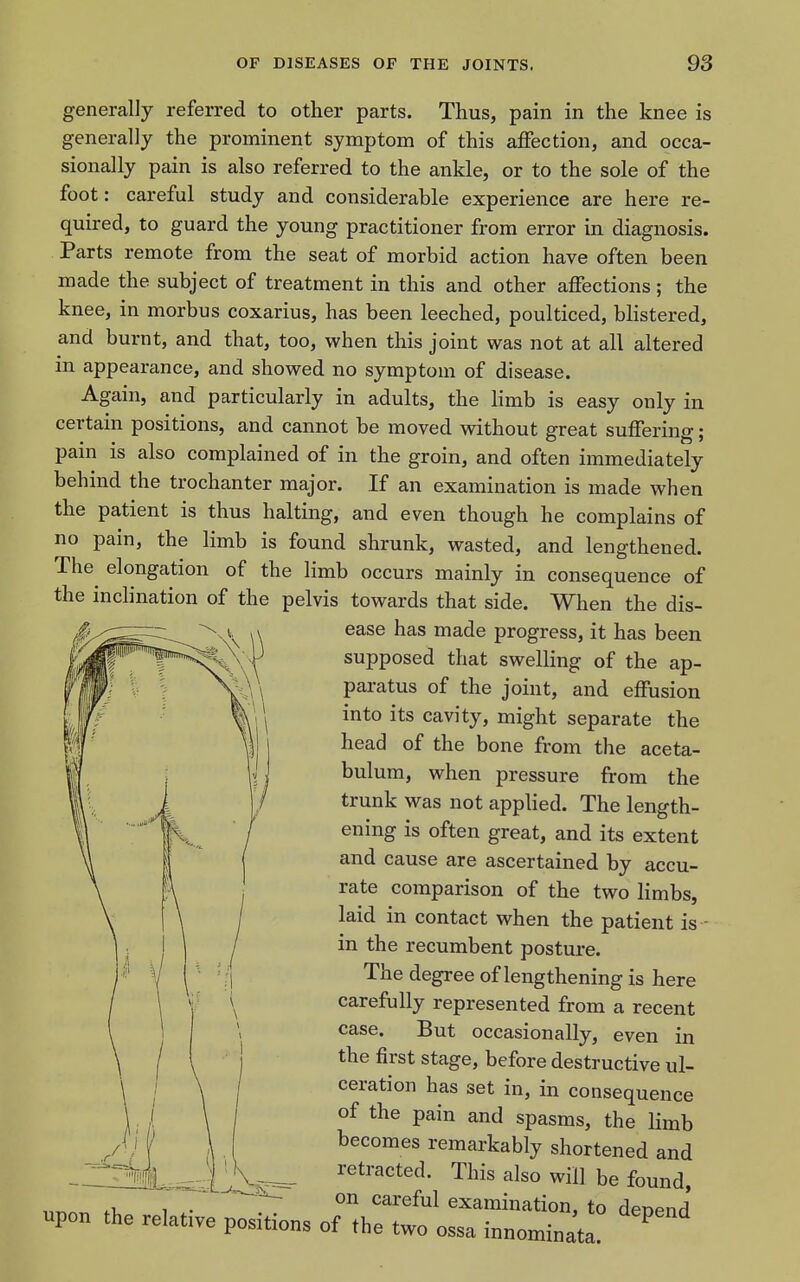 generally referred to other parts. Thus, pain in the knee is generally the prominent symptom of this affection, and occa- sionally pain is also referred to the ankle, or to the sole of the foot: careful study and considerable experience are here re- quired, to guard the young practitioner from error in diagnosis. Parts remote from the seat of morbid action have often been made the subject of treatment in this and other affections ; the knee, in morbus coxarius, has been leeched, poulticed, blistered, and burnt, and that, too, when this joint was not at all altered in appearance, and showed no symptom of disease. Again, and particularly in adults, the limb is easy only in certain positions, and cannot be moved without great suffering; pain is also complained of in the groin, and often immediately behind the trochanter major. If an examination is made when the patient is thus halting, and even though he complains of no pain, the limb is found shrunk, wasted, and lengthened. The elongation of the limb occurs mainly in consequence of the inclination of the pelvis towards that side. When the dis- ease has made progress, it has been supposed that swelling of the ap- paratus of the joint, and effusion into its cavity, might separate the head of the bone from the aceta- bulum, when pressure from the trunk was not applied. The length- ening is often great, and its extent and cause are ascertained by accu- rate comparison of the two limbs, laid in contact when the patient is - in the recumbent posture. The degree of lengthening is here carefully represented from a recent case. But occasionally, even in the first stage, before destructive ul- ceration has set in, in consequence of the pain and spasms, the Hmb becomes remarkably shortened and retracted. This also will be found, 1 . careful examination, to deoend upon the relative positions of the two ossa innominata' ^