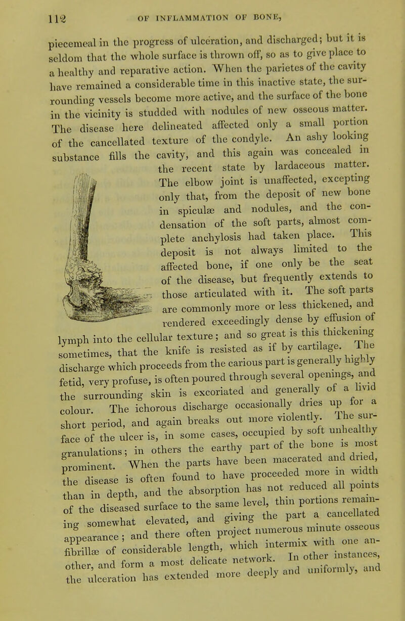 piecemeal in the progress of ulceration, and discharged; but it is seldom that the whole surface is thrown off, so as to give place to a healthy and reparative action. When the parietes of the cavity have remained a considerable time in this inactive state, tlie sur- rounding vessels become more active, and the surface of the bone in the vicinity is studded with nodules of new osseous matter. The disease here dehneated affected only a small portion of the cancellated texture of the condyle. An ashy looking substance fills the cavity, and this again was concealed in the recent state by lardaceous matter. The elbow joint is unaffected, excepting only that, from the deposit of new bone in spiculse and nodules, and the con- densation of the soft parts, almost com- plete anchylosis had taken place. This deposit is not always limited to the affected bone, if one only be the seat of the disease, but frequently extends to those articulated with it. The soft parts are commonly more or less thickened, and rendered exceedingly dense by effusion of lymph into the cellular texture; and so great is this thickening /ometimes, that the knife is resisted as if by cartilage. The discharge which proceeds from the carious part is generally highly fetid, very profuse, is often poured through several openings, and the surrounding skin is excoriated and generally of a hvid colour. The ichorous discharge occasionally dries up for a short period, and again breaks out more violently. Ihe sui- ace of the ulcer is, in some cases, occupied by soft unheaU^ granulations; in others the earthy part of the bone is most fromineiit. When the parts have been macerated and dried trdisea e is often found to have proceeded more m width than n depth, and the absorption has not reduced all points If L diseased surface to the same level thin portions remain- in 'somewhat elevated, and giving the part a cancellated ZeZZ- and there often project numerous minute osseous the ulceration has extended more deeply and un.foimb,