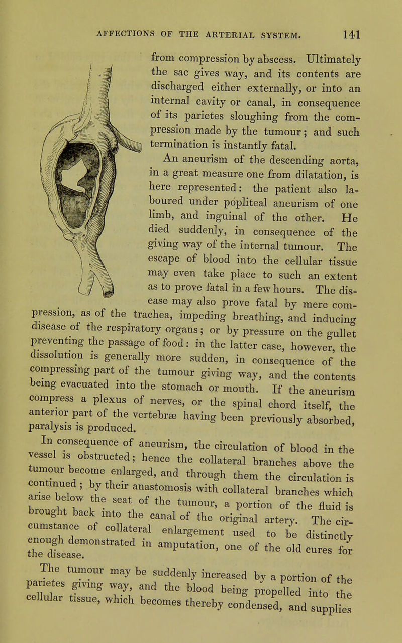 from compression by abscess. Ultimately the sac gives way, and its contents are discharged either externally, or into an internal cavity or canal, in consequence of its parietes sloughing from the com- pression made by the tumour; and such termination is instantly fatal. An aneurism of the descending aorta, in a great measiu-e one from dilatation, is here represented: the patient also la- boured under popliteal aneurism of one limb, and inguinal of the other. He died suddenly, in consequence of the giving way of the internal tumour. The escape of blood into the cellular tissue may even take place to such an extent as to prove fatal in a few hours. The dis- ease may also prove fatal by mere com- pression, as of the trachea, impeding breathing, and inducing disease of the respiratory organs; or by pressure on the gullet preventing the passage of food: in the latter case, however, the dissolution IS generally more sudden, in consequence of the compressing part of the tumour giving way, and the contents being evacuated into the stomach or mouth. If the aneurism compress a plexus of nerves, or the spinal chord itself, the anterior part of the vertebrae having been previously absorbed, paralysis is produced. x- ^ u. In consequence of aneurism, the circulation of blood in the vessel IS obstructed; hence the collateral branches above the ondnLdTT-'^''' ''^ - brnno-l.M. 1 \ ^ P°^*i° °f ^^e fluid is brought back into the canal of the original artery. The cir- cumstance of collateral enlargement used to be disdnctiy trteatr ^^^^^^^ in amputation, one of the old cures t The tumour may be suddenly increased by a portion of the pa letes giving way, and the blood being pLelled into tZ cellular tissue, which becomes thereby conlL^ andT;V'e: