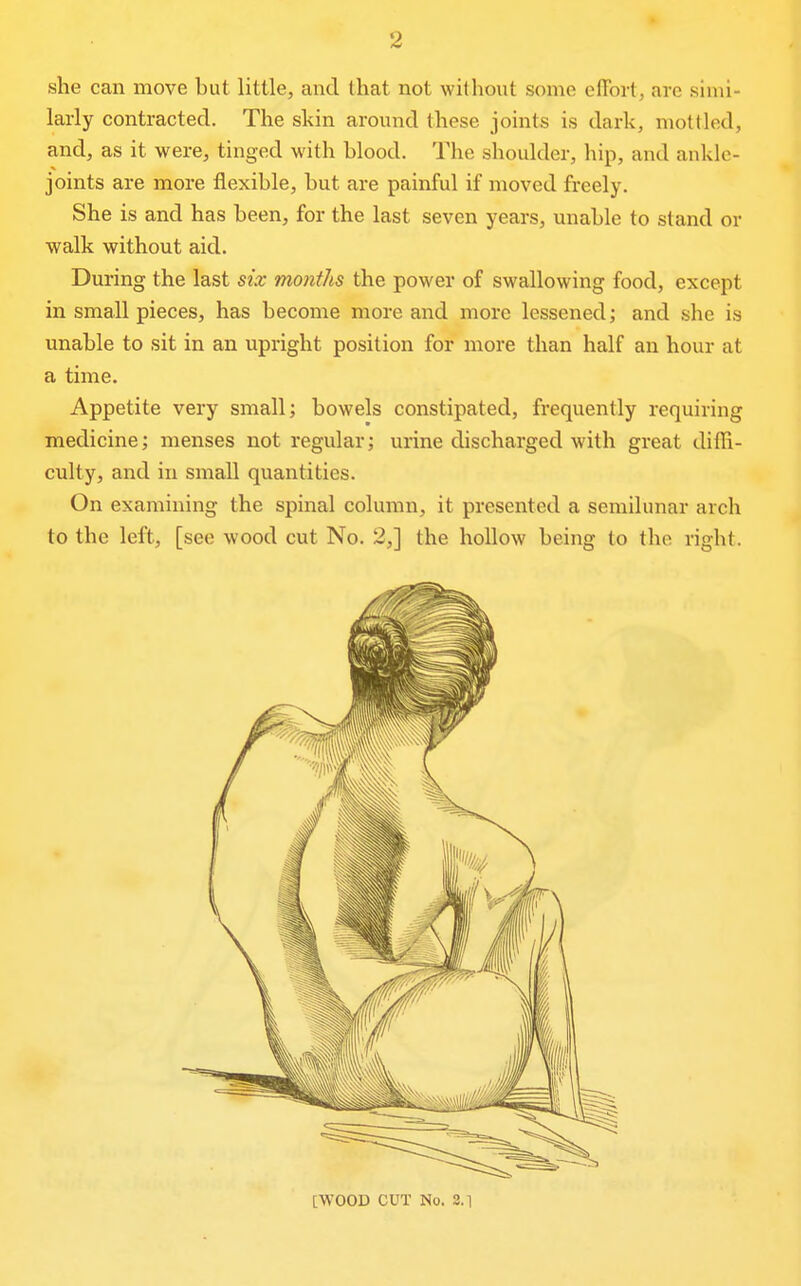 she can move but little, and that not without some effort, are simi- larly contracted. The skin around these joints is dark, mottled, and, as it were, tinged with blood. The shoulder, hip, and ankle- joints are more flexible, but are painful if moved freely. She is and has been, for the last seven years, unable to stand or walk without aid. During the last six months the power of swallowing food, except in small pieces, has become more and more lessened; and she is unable to sit in an upright position for more than half an hour at a time. Appetite very small; bowels constipated, frequently requiring medicine; menses not regular; urine discharged with great diffi- culty, and in small quantities. On examining the spinal column, it presented a semilunar arch to the left, [see wood cut No. 2,] the hollow being to the right. [WOOD CUT No. 8.1