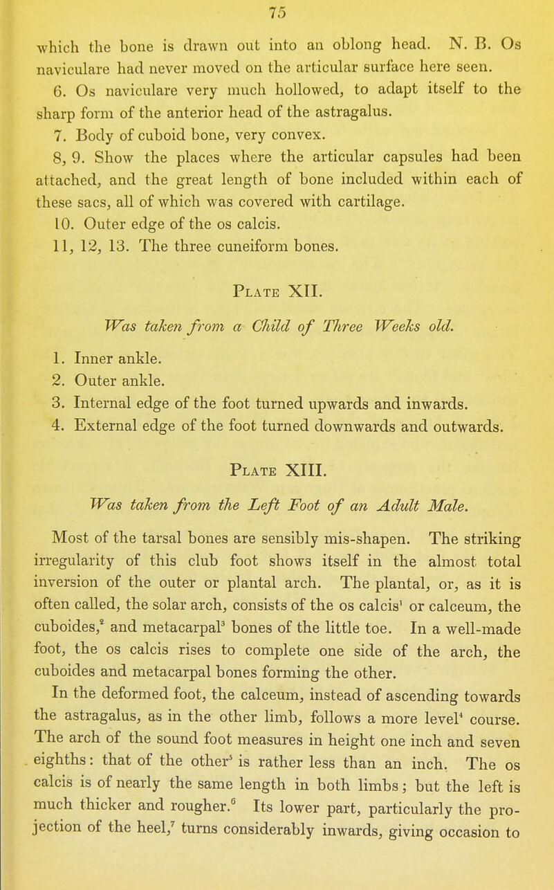 which the bone is drawn out into an oblong head. N. B. Os naviculare had never moved on the articular surface here seen. 6. Os naviculare very much hollowed, to adapt itself to the sharp form of the anterior head of the astragalus. 7. Body of cuboid bone, very convex. 8. 9. Show the places where the articular capsules had been attached, and the great length of bone included within each of these sacs, all of which was covered with cartilage. 10. Outer edge of the os calcis. 11, 12, 13. The three cuneiform bones. Plate XII. Was taken from a Child of Three Weeks old. 1. Inner ankle. 2. Outer ankle. 3. Internal edge of the foot turned upwards and inwards. 4. External edge of the foot turned downwards and outwards. Plate XIII. Was taken from the Left Foot of an Adult Male. Most of the tarsal bones are sensibly mis-shapen. The striking in-egularity of this club foot shows itself in the almost total inversion of the outer or plantal arch. The plantal, or, as it is often called, the solar arch, consists of the os calcis' or calceum, the cuboides,* and metacarpal bones of the little toe. In a well-made foot, the OS calcis rises to complete one side of the arch, the cuboides and metacarpal bones forming the other. In the deformed foot, the calceum, instead of ascending towards the astragalus, as in the other limb, follows a more level' course. The arch of the sound foot measures in height one inch and seven eighths: that of the other* is rather less than an inch. The os calcis is of nearly the same length in both limbs; but the left is much thicker and rougher.' Its lower part, particularly the pro- jection of the heeV turns considerably inwards, giving occasion to