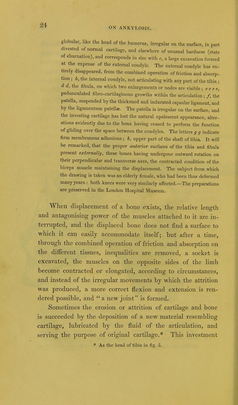 ON ANKYLOSIS. globular, like the head of the humerus, irregular on the surface, in part divested of normal cartilage, and elsewhere of unusual hardness (state of eburnation), and corresponds in size with c, a large excavation formed at the expense of the external condyle. The external condyle has en- tirely disappeared, from the combined operation of friction and absorp- tion ; 6, the internal condyle, not articulating with any part of the tibia ; d d, the fibula, on which two enlargements or nodes are visible; eeee, pedunculated fibro-cartUaginous growths within the articulation; /, the pateUa, suspended by the thickened and indurated capsular Ugament, and by the ligamentum patellae. The pateUa is irregular on the surface, and the investing cartUage has lost the natural opalescent appearance, alter- ations evidently due to the bone having ceased to perform the function of gliding over the space between the condyles. The letters ff g indicate firm membranous adhesions ; h, upper part of the shaft of tihia. It will be remarked, that the proper anterior surfaces of the tibia and fibula present externally, these bones having undergone outward rotation on their perpendicular and transverse axes, the contracted condition of the biceps muscle maintaining the displacement. The subject from which the drawing is taken was an elderly female, who had been thus deformed many years : both knees were very similarly affected.—The preparations are preserved in the London Hospital Museum. When displacement of a bone exists, the relative length and antagonising power of the muscles attached to it are in- terrupted, and the displaced bone does not find a surface to which it can easily accommodate itself; but after a time, through the combined operation of friction and absorption on the different tissues, inequalities are removed, a socket is excavated, the muscles on the opposite sides of the limb become contracted or elongated, according to circumstances, and instead of the irregular movements by which the attrition was produced, a more correct flexion and extension is ren- dered possible, and a new joint is formed. Sometimes the erosion or attrition of cartilage and bone is succeeded by the deposition of a new material resembling cartilage, lubricated by the fluid of the articulation, and serving the purpose of original cartilage.* This investment * As the head of tibia in fig. 5,