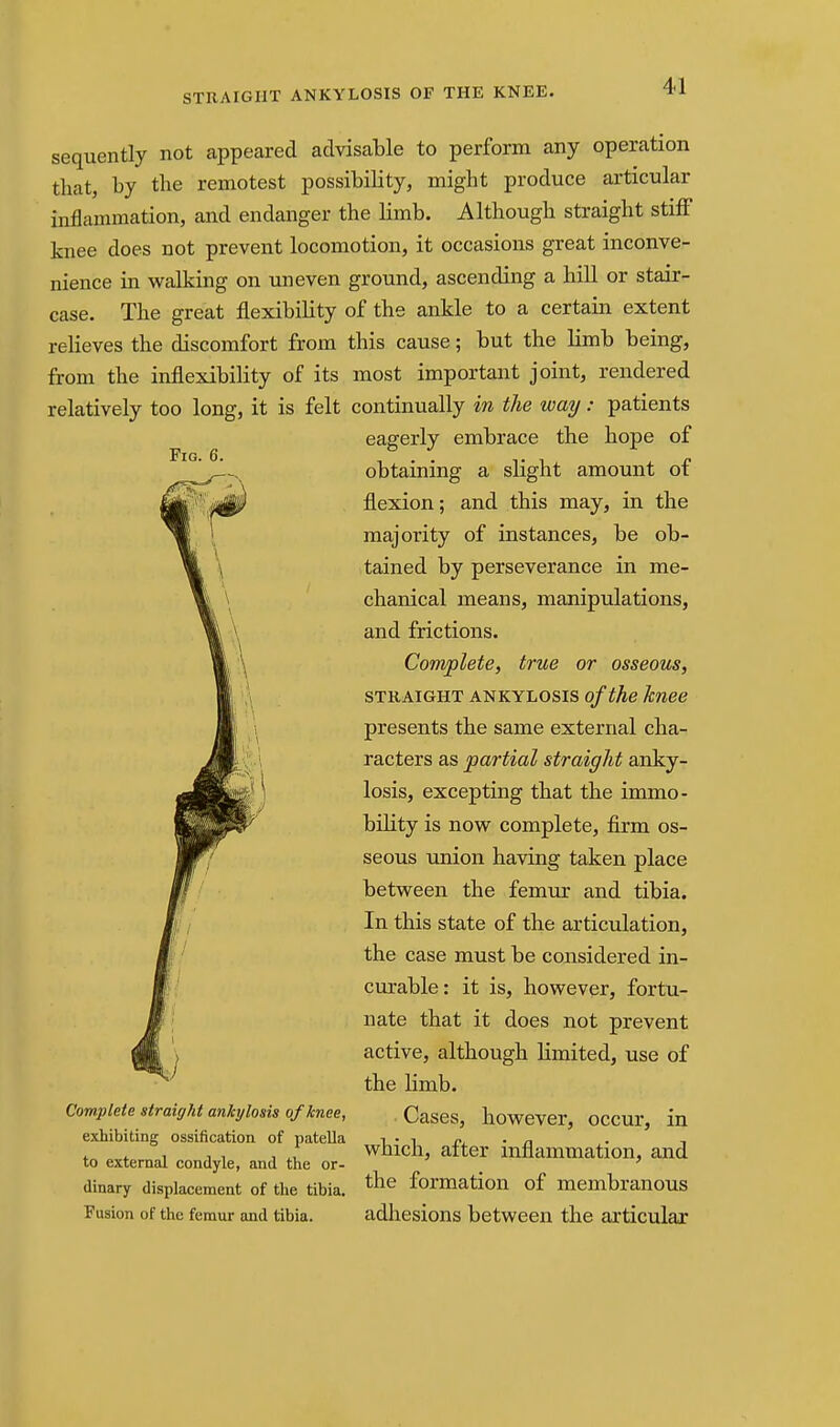 Fig. 6. sequently not appeared advisable to perform any operation that, by the remotest possibility, might produce articular inflammation, and endanger the limb. Although straight stifF knee does not prevent locomotion, it occasions great inconve- nience in walking on uneven ground, ascending a hill or stair- case. The great flexibility of the ankle to a certain extent relieves the discomfort from this cause; but the limb being, from the inflexibility of its most important joint, rendered relatively too long, it is felt continually in the way: patients eagerly embrace the hope of obtaining a slight amount of flexion; and this may, in the majority of instances, be ob- tained by perseverance in me- chanical means, manipulations, and frictions. Complete, true or osseous, STRAIGHT ANKYLOSIS of the knee presents the same external cha- racters as partial straight anky- losis, excepting that the immo- bility is now complete, firm os- seous union having taken place between the femur and tibia. In this state of the articulation, the case must be considered in- curable: it is, however, fortu- nate that it does not prevent active, although limited, use of the limb. Cases, however, occur, in which, after inflammation, and the formation of membranous adliesions between the articular Complete straight ankylosis of knee, exhibiting ossification of patella to external condyle, and the or- dinary displacement of the tibia. Fusion of the femur and tibia.