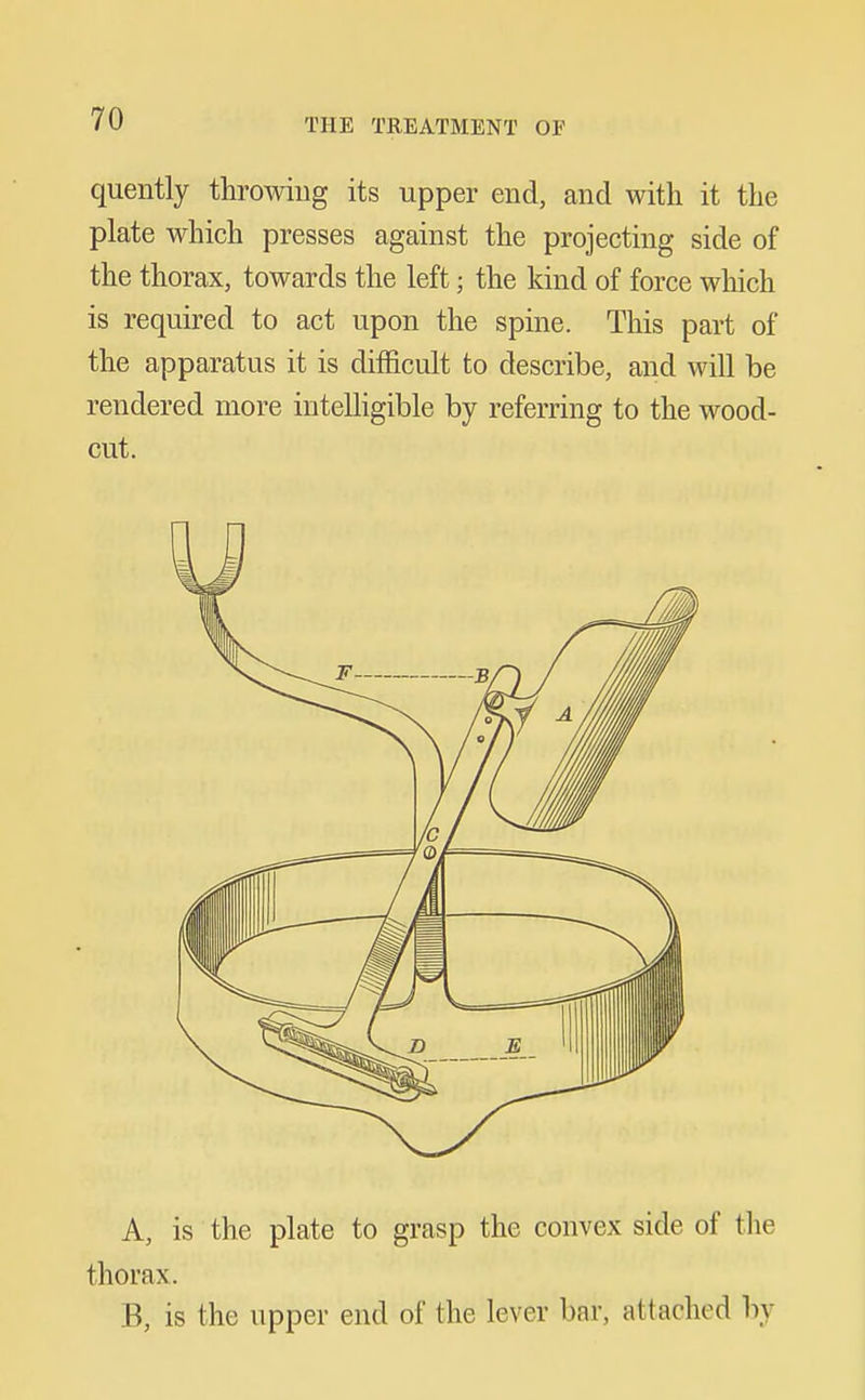 quently throwing its upper end, and with it the plate which presses against the projecting side of the thorax, towards the left; the kind of force wliich is required to act upon the spine. This part of the apparatus it is difficult to describe, and will be rendered more iuteUigible by referring to the wood- cut. A, is the plate to grasp the convex side of the thorax. B, is the upper end of the lever bar, attached by