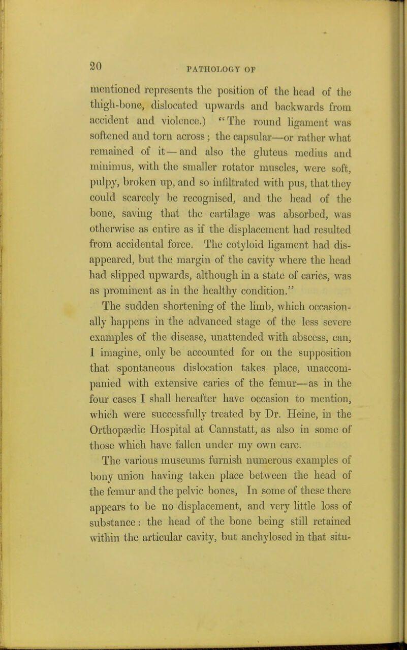 PATHOLOGY OF mentioned represents the position of the head of the thigh-bone, dislocated upwards and backwards from accident and violence.) The round ligament was softened and torn across; the capsular—or rather what remained of it—and also the gluteus medius and minimus, with the smaller rotator muscles, were soft, pulpy, broken up, and so infiltrated with pus, that they could scarcely be recognised, and the head of the bone, saving that the cartilage was absorbed, was otherwise as entire as if the displacement had resulted from accidental force. The cotyloid ligament had dis- appeared, but the margin of the cavity where the head had slipped upwards, although in a state of caries, was as prominent as in the healthy condition. The sudden shortening of the limb, which occasion- ally happens in the advanced stage of the less severe examples of the disease, unattended with abscess, can, I imagine, only be accounted for on the supposition that spontaneous dislocation takes place, unaccom- panied with extensive caries of the femur—as in the four cases I shall hereafter have occasion to mention, which were successfully treated by Dr. Heine, in the Orthopaedic Hospital at Cannstatt, as also in some of those which have fallen under my own care. The various museums furnish numerous examples of bony union having taken place between the head of the femur and the pelvic bones, In some of these there appears to be no displacement, and very little loss of substance: the head of the bone being still retained within the articular cavity, but anchylosed in that situ-