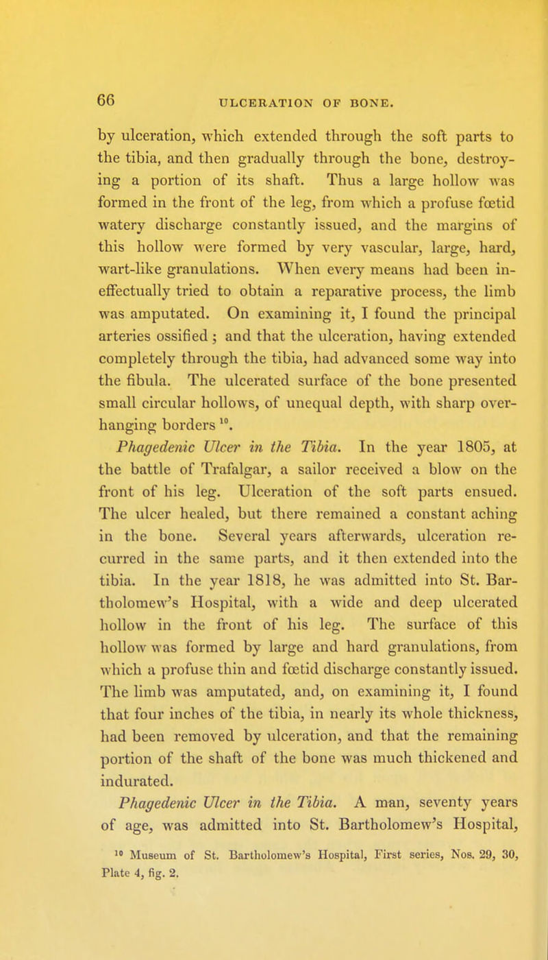 by ulceration, which extended through the soft parts to the tibia, and then gradually through the bone, destroy- ing a portion of its shaft. Thus a large hollow was formed in the front of the leg, from which a profuse foetid watery discharge constantly issued, and the margins of this hollow were formed by very vascular, large, hard, wart-like granulations. When every means had been in- effectually tried to obtain a reparative process, the limb was amputated. On examining it, I found the principal arteries ossified ; and that the ulceration, having extended completely through the tibia, had advanced some way into the fibula. The ulcerated surface of the bone presented small circular hollows, of unequal depth, with sharp over- hanging borders 10. Phagedenic Ulcer in the Tibia. In the year 1805, at the battle of Trafalgar, a sailor received a blow on the front of his leg. Ulceration of the soft parts ensued. The ulcer healed, but there remained a constant aching in the bone. Several years afterwards, ulceration re- curred in the same parts, and it then extended into the tibia. In the year 1818, he was admitted into St. Bar- tholomew's Hospital, with a wide and deep ulcerated hollow in the front of his leg. The surface of this hollow was formed by large and hard granulations, from which a profuse thin and foetid discharge constantly issued. The limb was amputated, and, on examining it, I found that four inches of the tibia, in nearly its whole thickness, had been removed by ulceration, and that the remaining portion of the shaft of the bone was much thickened and indurated. Phagedenic Ulcer in the Tibia. A man, seventy years of age, was admitted into St. Bartholomew's Hospital, 10 Museum of St. Bartholomew's Hospital, First series, Nos. 29, 30, Plate 4, fig. 2.