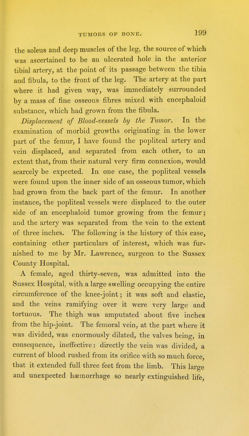the soleus and deep muscles of the leg, the source of which was ascertained to be an ulcerated hole in the anterior tibial artery, at the point of its passage between the tibia and fibula, to the front of the leg. The artery at the part where it had given way, was immediately surrounded by a mass of fine osseous fibres mixed with encephaloid substance, which had grown from the fibula. Displacement of Blood-vessels by the Tumor. In the examination of morbid growths originating in the lower part of the femur, I have found the popliteal artery and vein displaced, and separated from each other, to an extent that, from their natural very firm connexion, would scarcely be expected. In one case, the popliteal vessels were found upon the inner side of an osseous tumor, which had grown from the back part of the femur. In another instance, the popliteal vessels were displaced to the outer side of an encephaloid tumor growing from the femur; and the artery was separated from the vein to the extent of three inches. The following is the history of this case, containing other particulars of interest, which was fur- nished to me by Mr. Lawrence, surgeon to the Sussex County Hospital. A female, aged thirty-seven, was admitted into the Sussex Hospital, with a large swelling occupying the entire circumference of the knee-joint; it was soft and elastic, and the veins ramifying over it were very large and tortuous. The thigh was amputated about five inches from the hip-joint. The femoral vein, at the part where it w as divided, was enormously dilated, the valves being, in consequence, ineffective: directly the vein was divided, a current of blood rushed from its orifice with so much force, that it extended full three feet from the limb. This large and unexpected haemorrhage so nearly extinguished life,