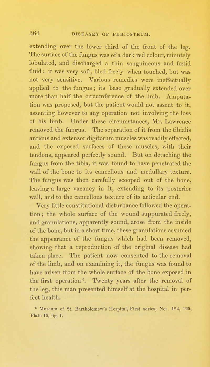 extending over the lower third of the front of the leg. The surface of the fungus was of a dark red colour, minutely lobulated, and discharged a thin sanguineous and foetid fluid: it was very soft, bled freely when touched, but was not very sensitive. Various remedies were ineffectually applied to the fungus; its base gradually extended over more than half the circumference of the limb. Amputa- tion was proposed, but the patient would not assent to it, assenting however to any operation not involving the loss of his limb. Under these circumstances, Mr. Lawrence removed the fungus. The separation of it from the tibialis anticus and extensor digitorum muscles was readily effected, and the exposed surfaces of these muscles, with their tendons, appeared perfectly sound. But on detaching the fungus from the tibia, it was found to have penetrated the wall of the bone to its cancellous and medullary texture. The fungus was then carefully scooped out of the bone, leaving a large vacancy in it, extending to its posterior wall, and to the cancellous texture of its articular end. Very little constitutional disturbance followed the opera- tion ; the whole surface of the wound suppurated freely, and granulations, apparently sound, arose from the inside of the bone, but in a short time, these granulations assumed the appearance of the fungus which had been removed, showing that a reproduction of the original disease had taken place. The patient now consented to the removal of the limb, and on examining it, the fungus was found to have arisen from the whole surface of the bone exposed in the first operation °. Twenty years after the removal of the leg, this man presented himself at the hospital in per- fect health. 6 Museum of St. Bartholomew's Hospital, First series, Nos. 124, 125, Plate 15, fig. I.