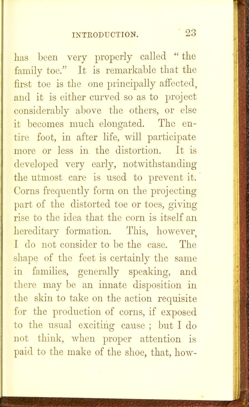 lias been very properly called  the family toe. It is remarkable that the first toe is the one principally affected, and it is either curved so as to project considerably above the others, or else- it becomes much elongated. The en- tire foot, in after life, will participate more or less in the distortion. It is developed very early, notwithstanding the utmost care is used to prevent it. Corns frequently form on the projecting part of the distorted toe or toes, giving rise to the idea that the com is itself an hereditary formation. This, however I do not consider to be the case. The shape of the feet is certainly the same in families, generally speaking, and there may be an innate disposition in the skin to take on the action requisite for the production of corns, if exposed to the usual exciting cause ; but I do not think, when proper attention is paid to the make of the shoe, that, how-