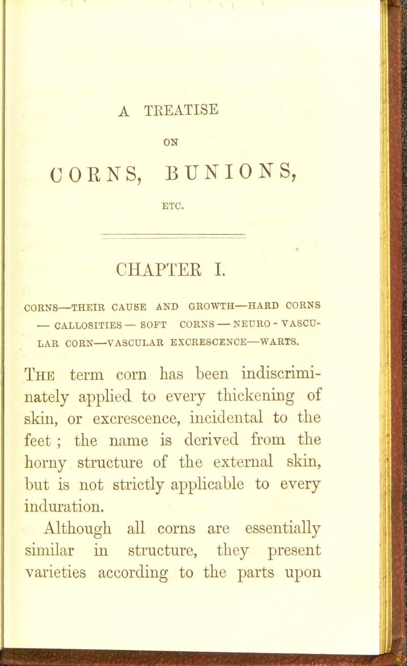 A TEEATISE ON CORNS, BUNIONS, ETC. CHAPTER I. CORNS—THEIR CAUSE AND GROWTH—HARD CORNS — CALLOSITIES — SOFT CORNS — NEURO - VASCU- LAR CORN—VASCULAR EXCRESCENCE—WARTS. The term corn has been indiscrimi- nately applied to every thickening of skin, or excrescence, incidental to the feet; the name is derived from the horny structure of the external skin, but is not strictly applicable to every induration. Although all corns are essentially similar in structure, they present varieties according to the parts upon