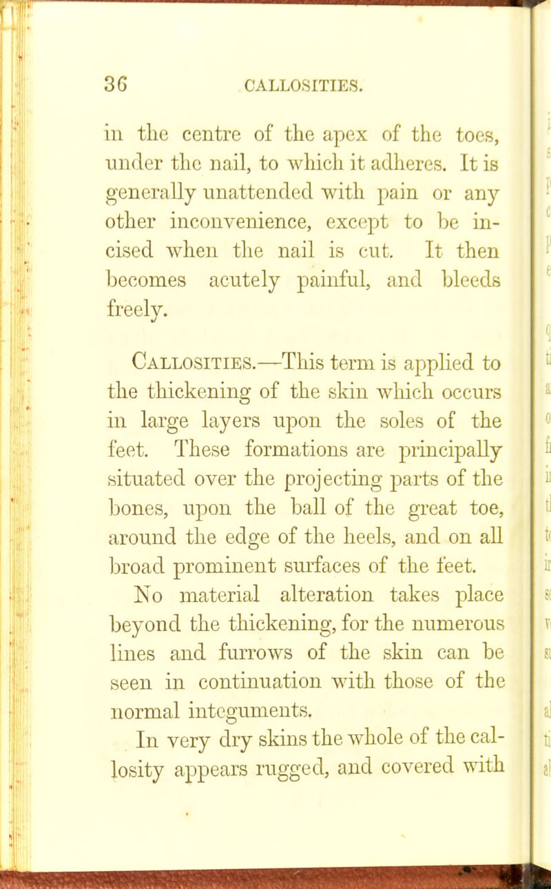 in the centre of the apex of the toes, under the nail, to which it adheres. It is generally unattended with pain or any other inconvenience, except to be in- cised when the nail is cut. It then becomes acutely painful, and bleeds freely. Callosities.—This term is applied to the thickening of the skin which occurs in large layers upon the soles of the feet. These formations are principally situated over the projecting parts of the bones, upon the ball of the great toe, around the edge of the heels, and on all broad prominent surfaces of the feet. No material alteration takes place beyond the thickening, for the numerous lines and furrows of the skin can be seen in continuation with those of the normal integuments. In very dry skins the whole of the cal- losity appears rugged, and covered with