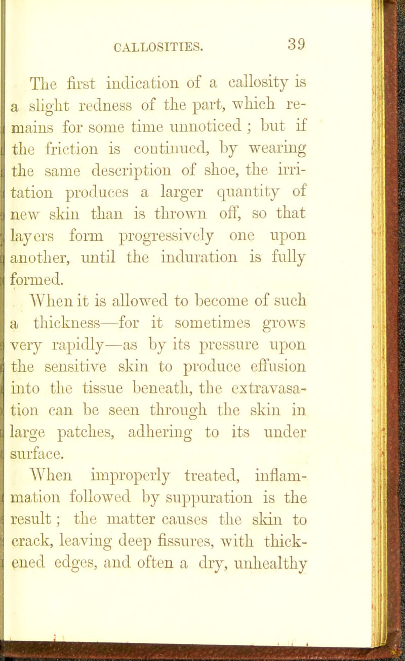 The first indication of a callosity is a slight redness of the part, which re- mains for some time unnoticed ; but if the friction is continued, by wearing the same description of shoe, the irri- tation produces a larger quantity of new skin than is thrown off, so that layers form progressively one upon another, until the induration is fully formed. When it is allowed to become of such a thickness—for it sometimes grows very rapidly—as by its pressure upon the sensitive skin to produce effusion into the tissue beneath, the extravasa- tion can be seen throusfh the skin in large patches, adhering to its under surface. When improperly treated, inflam- mation followed by suppuration is the result; the matter causes the skin to crack, leaving deep fissures, with thick- ened edges, and often a dry, unhealthy