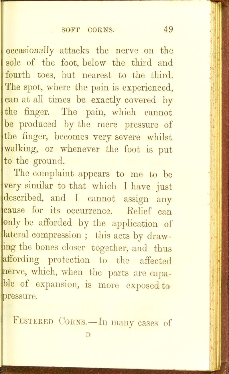 occasionally attacks the nerve on the sole of the foot, below the third and fourth toes, but nearest to the third. The spot, where the pain is experienced, can at all times be exactly covered by the finger. The pain, which cannot be produced by the mere pressure of the finger, becomes very severe whilst walking, or whenever the foot is put to the ground. The complaint appears to me to be very similar to that which I have just described, and I cannot assign any cause for its occurrence. Eelief can only be afforded by the application of lateral compression ; this acts by draw- ing the bones closer together, and thus affording protection to the affected nerve, which, when the parts are capa- ble of expansion, is more exposed to pressure. Festered Corns.—In many cases of D