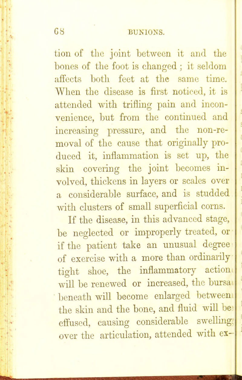 GS BUNIONS. tion of the joint between it and the bones of the foot is changed ; it seldom affects both feet at the same time. When the disease is first noticed, it is attended with trifling pain and incon- venience, but from the continued and increasing pressure, and the non-re- moval of the cause that originally pro- duced it, inflammation is set up, the skin covering the joint becomes in- volved, thickens in layers or scales over a considerable surface, and is studded with clusters of small superficial corns. If the disease, in this advanced stage, be neglected or improperly treated, or if the patient take an unusual degree of exercise with a more than ordinarily tight shoe, the inflammatory action i will be renewed or increased, the bursas beneath will become enlarged between the skin and the bone, and fluid will be effused, causing considerable swelling, over the articulation, attended with ex-
