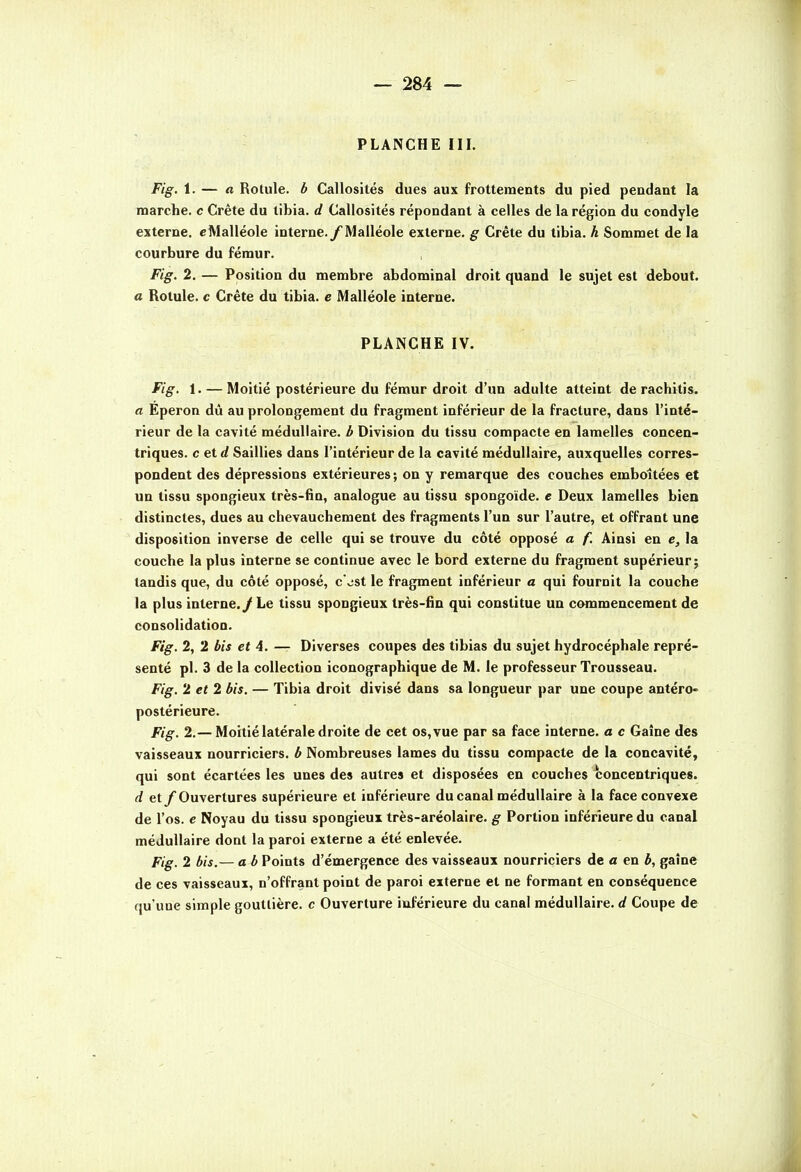 PLANCHE III. Fig, 1. — « Rotule, b Callosités dues aux frottements du pied pendant la marche, c Crête du tibia, d Callosités répondant à celles de la région du condyle externe, c Malléole interne./Malléole externe, g Crète du tibia, h Sommet de la courbure du fémur. Fig. 2. — Position du membre abdominal droit quand le sujet est debout. a Rotule, c Crête du tibia, e Malléole interne. PLANCHE IV. Fig. 1. — Moitié postérieure du fémur droit d'un adulte atteint de rachitis. a Eperon dû au prolongement du fragment inférieur de la fracture, dans l'inté- rieur de la cavité médullaire, b Division du tissu compacte en lamelles concen- triques, c et </ Saillies dans l'intérieur de la cavité médullaire, auxquelles corres- pondent des dépressions extérieures; on y remarque des couches emboîtées et un tissu spongieux très-fin, analogue au tissu spongoïde. e Deux lamelles bien distinctes, dues au chevauchement des fragments l'un sur l'autre, et offrant une disposition inverse de celle qui se trouve du côté opposé a f. Ainsi en e, la couche la plus interne se continue avec le bord externe du fragment supérieur; tandis que, du côté opposé, c'ost le fragment inférieur a qui fournit la couche la plus interne. / Le tissu spongieux très-fin qui constitue un commencement de consolidation. Fig. 2, 2 bis et 4. — Diverses coupes des tibias du sujet hydrocéphale repré- senté pl. 3 de la collection iconographique de M. le professeur Trousseau. Fig. 2 et 2 bis. — Tibia droit divisé dans sa longueur par une coupe antéro» postérieure. Fig. 2.— Moitié latérale droite de cet os, vue par sa face interne, a c Gaine des vaisseaux nourriciers, b Nombreuses lames du tissu compacte de la concavité, qui sont écartées les unes des autres et disposées en couches concentriques. d et/Ouvertures supérieure et inférieure du canal médullaire à la face convexe de l'os, e Noyau du tissu spongieux très-aréolaire. g Portion inférieure du canal médullaire dont la paroi externe a été enlevée. Fig. 2 bis.— a b Points d'émergence des vaisseaux nourriciers de a en b, gaine de ces vaisseaux, n'offrant point de paroi externe et ne formant en conséquence qu'une simple gouttière, c Ouverture inférieure du canal médullaire, d Coupe de