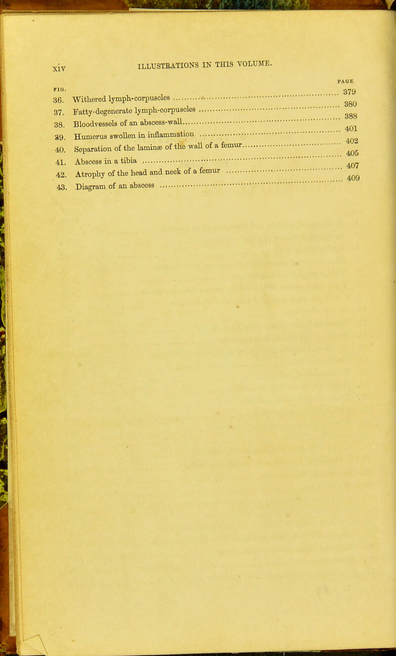 ILLUSTRATIONS IN THIS VOLUME. PA FIO. 36. Withered lymph-corpuscles .• 37. Patty-degenerate lymph-corpuscles 38. Bloodvessels of an absoess-waU. 39. Humerus swollen in inflammation 40. Separation of the laminee of the waU of a femur 41. Abscess in a tibia 42. Atrophy of the head and neck of a femur 43. Diagram of an abscess