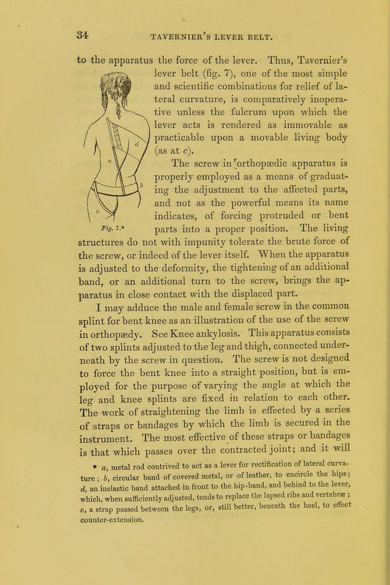 rraer s Fig. 7* to the apparatus the force of the lever. Thus, Taven lever belt (fig. 7), one of the most simple and scientific combinations for relief of la- teral curvature, is comparatively inopera- tive unless the fulcrum upon which the lever acts is rendered as immovable as practicable upon a movable living body (as at c). The screw in ^orthopaedic apparatus is properly employed as a means of graduat- ing the adjustment to the affected parts, and not as the powerful means its name indicates, of forcing protruded or bent parts into a proper position. The living structures do not with impunity tolerate the brute force of the screw, or indeed of the lever itself. When the apparatus is adjusted to the deformity, the tightening of an additional band, or an additional turn to the screw, brings the ap- paratus in close contact with the displaced part. I may adduce the male and female screw in the common splint for bent knee as an illustration of the use of the screw in orthopaedy. See Knee ankylosis. This apparatus consists of two splints adjusted to the leg and thigh, connected under- neath by the screw in question. The screw is not designed to force the bent knee into a straight position, but is em- ployed for the purpose of varying the angle at which the leg and knee splints are fixed in relation to each other. The work of straightening the limb is effected by a series of straps or bandages by which the limb is secured in the instrument. The most effective of these straps or bandages is that which passes over the contracted joint; and it will • a, metal rod contrived to act as a lever for rectification of lateral curva- ture • b, circular band of covered metal, or of leather, to encircle the hips; d, an inelastic band attached in front to the hip-band, and behind to the lever, which, when sufficiently adjusted, tends to replace the lapsed ribs and vertebra:; o, a strap passed between the legs, or, still better, beneath the heel, to effect counter-extension.