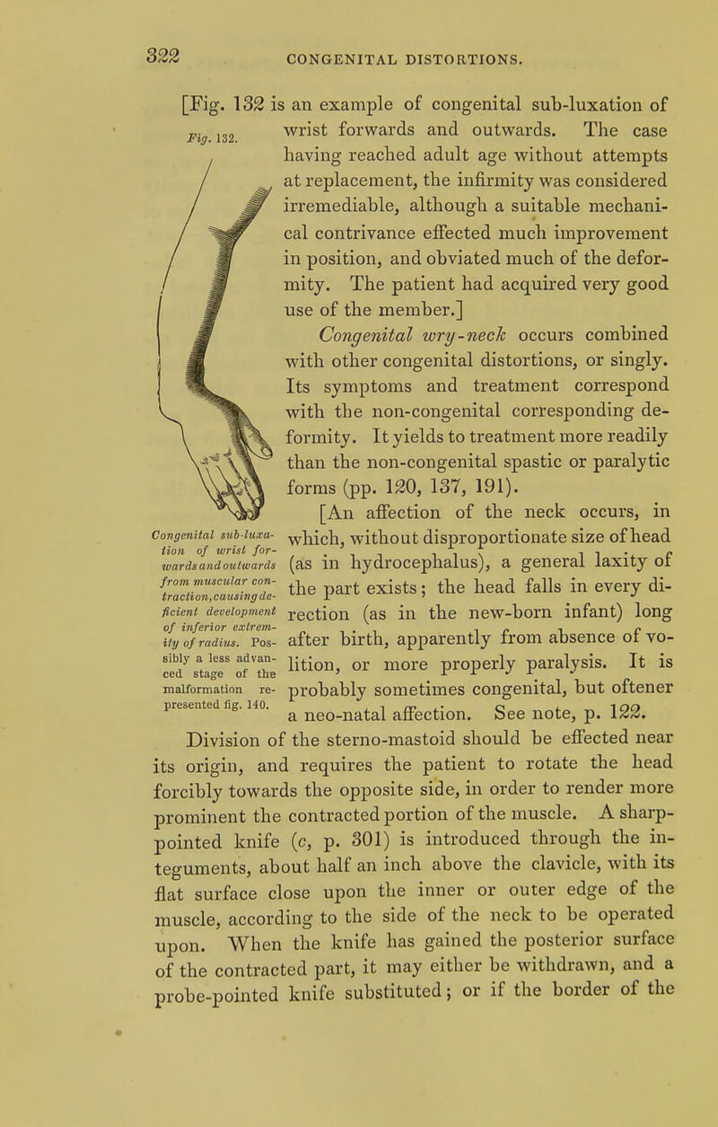 Fig. 132. [Fig. 132 is an example of congenital sub-luxation of wrist forwards and outwards. The case having reached adult age without attempts at replacement, the infirmity was considered irremediable, although a suitable mechani- cal contrivance effected much improvement in position, and obviated much of the defor- mity. The patient had acquired very good use of the member.] Congenital wry-neck occurs combined with other congenital distortions, or singly. Its symptoms and treatment correspond with the non-congenital corresponding de- formity. It yields to treatment more readily than the non-congenital spastic or paralytic forms (pp. 120, 137, 191). [An affection of the neck occurs, in congenital sub-iuxa- which without disproportionate size of head Hon of wrist for- . iif l 1 C wards and outwards (as in hydrocephalus), a general laxity ot izrz^ltthe part exists->the head falls.in everydi- fident development rection (as in the new-born infant) long of inferior extrem- „',.•, t i> l c ity of radius. Pos- after birth, apparently from absence ol vo- SfstaS'S'Sto lition> or more ProPerlJ paralysis. It is malformation re- probably sometimes congenital, but oftener presented fig. ho. ^ ne0_natal affection. See note, p. 122. Division of the sterno-mastoid should be effected near its origin, and requires the patient to rotate the head forcibly towards the opposite side, in order to render more prominent the contracted portion of the muscle. A sharp- pointed knife (c, p. 301) is introduced through the in- teguments, about half an inch above the clavicle, with its flat surface close upon the inner or outer edge of the muscle, according to the side of the neck to be operated upon. When the knife has gained the posterior surface of the contracted part, it may either be withdrawn, and a probe-pointed knife substituted; or if the border of the