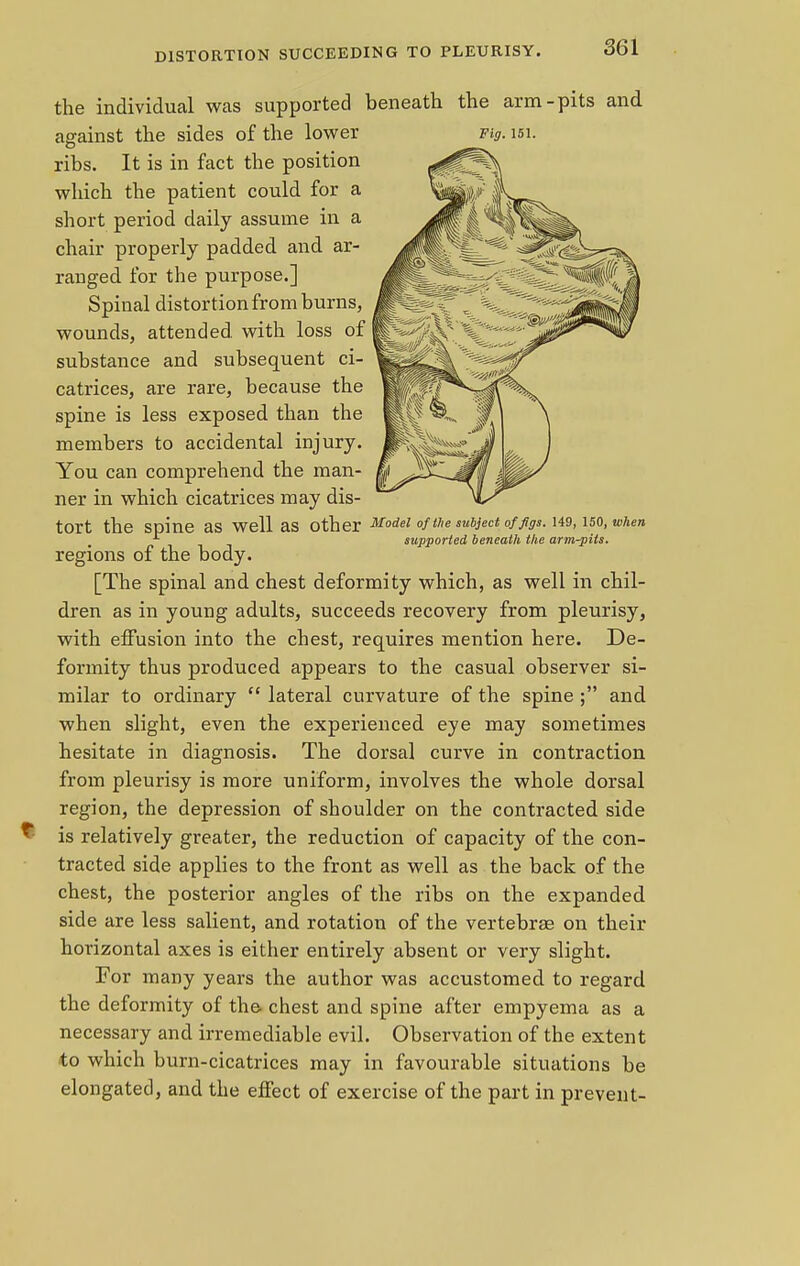 the individual was supported beneath the arm-pits and against the sides of the lower ribs. It is in fact the position which the patient could for a short period daily assume in a chair properly padded and ar- ranged for the purpose.] Spinal distortion from burns, wounds, attended with loss of substance and subsequent ci- catrices, are rare, because the spine is less exposed than the members to accidental injury. You can comprehend the man- ner in which cicatrices may dis- tort the spine as Well as Other Model of the subject of figs. U9,U0, when *■ supported beneath the arm-pits. regions of the body. [The spinal and chest deformity which, as well in chil- dren as in young adults, succeeds recovery from pleurisy, with effusion into the chest, requires mention here. De- formity thus produced appears to the casual observer si- milar to ordinary  lateral curvature of the spine ; and when slight, even the experienced eye may sometimes hesitate in diagnosis. The dorsal curve in contraction from pleurisy is more uniform, involves the whole dorsal region, the depression of shoulder on the contracted side is relatively greater, the reduction of capacity of the con- tracted side applies to the front as well as the back of the chest, the posterior angles of the ribs on the expanded side are less salient, and rotation of the vertebrae on their horizontal axes is either entirely absent or very slight. For many years the author was accustomed to regard the deformity of the chest and spine after empyema as a necessary and irremediable evil. Observation of the extent to which burn-cicatrices may in favourable situations be elongated, and the effect of exercise of the part in prevent- Fig. 151.