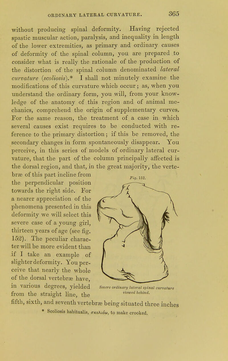 without producing spinal deformity. Having rejected spastic muscular action, paralysis, and inequality in length of the lower extremities, as primary and ordinary causes of deformity of the spinal column, you are prepared to consider what is really the rationale of the production of the distortion of the spinal column denominated lateral curvature (scoliosis).* I shall not minutely examine the modifications of this curvature which occur ; as, when you understand the ordinary form, you will, from your know- ledge of the anatomy of this region and of animal me- chanics, comprehend the origin of supplementary curves. For the same reason, the treatment of a case in which several causes exist requires to be conducted with re- ference to the primary distortion ; if this be removed, the secondary changes in form spontaneously disappear. You perceive, in this series of models of ordinary lateral cur- vature, that the part of the column principally affected is the dorsal region, and that, in the great majority, the verte- brae of this part incline from _. *■ Fig. 152. the perpendicular position towards the right side. For a nearer appreciation of the phenomena presented in this deformity we will select this severe case of a young girl, thirteen years of age (see fig. 152). The peculiar charac- ter will be more evident than if I take an example of slighter deformity. You per- ceive that nearly the whole of the dorsal vertebrae have, in various degrees, yielded from the straight line, the fifth, sixth, and seventh vertebrae being situated three inches * Scoliosis habitualis, ctko\i6u, to make crooked. Severe ordinary lateral, spinal curvature viewed behind.