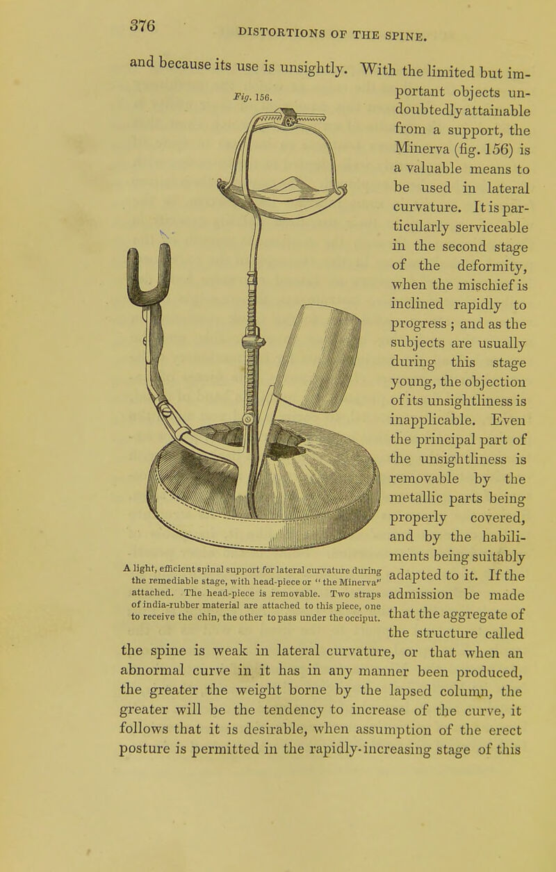 DISTORTIONS OF THE SPINE. Fir/. 156. and because its use is unsightly. With the limited but im- portant objects un- doubtedly attainable from a support, the Minerva (fig. 156) is a valuable means to be used in lateral curvature. It is par- ticularly serviceable in the second stage of the deformity, when the mischief is inclined rapidly to progress ; and as the subjects are usually during this stage young, the objection of its unsightliness is inapplicable. Even the principal part of the unsightliness is removable by the metallic parts being properly covered, and by the habili- ments being suitably Alight, efficient spinal support for lateral curvature during nrl.,rirprl fn if Tf fl the remediable stage, with head-piece or  the Minerva cludPL(-u to «• 11 cne attached. The head-piece is removable. Two straps admission be made of india-iubber material are attached to this piece, one .1 , , 1 c to receive the chin, the other to pass under the occiput, tuat the aggregate 01 the structure called the spine is weak in lateral curvature, or that when an abnormal curve in it has in any manner been produced, the greater the weight borne by the lapsed column, the greater will be the tendency to increase of the curve, it follows that it is desirable, when assumption of the erect posture is permitted in the rapidly-increasing stage of this