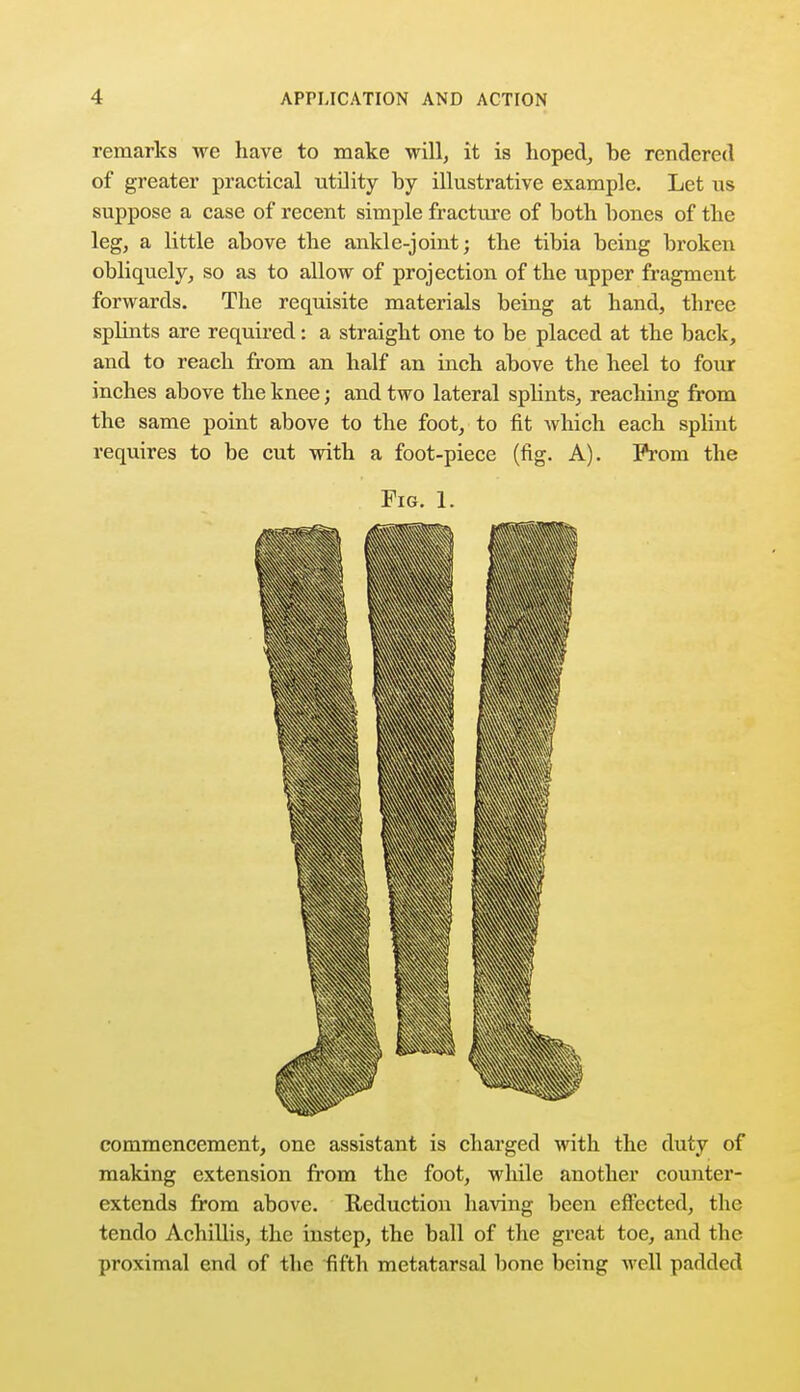 remarks we have to make will, it is hoped, he rendered of greater practical utility hy illustrative example. Let us suppose a case of recent simple fracture of both hones of the leg, a little above the ankle-joint; the tibia being broken obliquely, so as to allow of projection of the upper fragment forwards. The requisite materials being at hand, three splints are required: a straight one to be placed at the back, and to reach from an half an inch above the heel to four inches above the knee; and two lateral splints, reaching from the same point above to the foot, to fit which each splint requires to be cut with a foot-piece (fig. A). Prom the Fig. 1. commencement, one assistant is charged with the duty of making extension from the foot, while another counter- extends from above. Reduction having been effected, the tendo Achillis, the instep, the ball of the great toe, and the proximal end of the fifth metatarsal bone being well padded