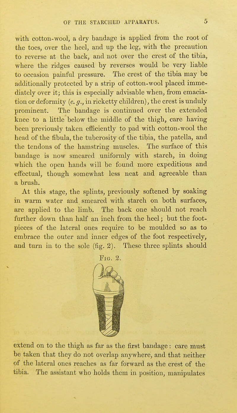 with cotton-wool, a dry bandage is applied from the root of the toes, over the heel, and up the leg, with the precaution to reverse at the back, and not over the crest of the tibia, where the ridges caused by reverses would be very liable to occasion painful pressure. The crest of the tibia may be additionally protected by a strip of cotton-wool placed imme- diately over it; this is especially advisable when, from emacia- tion or deformity (e. g., in ricketty children), the crest is unduly prominent. The bandage is continued over the extended knee to a little below the middle of the thigh, care having been previously taken efficiently to pad with cotton-wool the head of the fibula, the tuberosity of the tibia, the patella, and the tendons of the hamstring muscles. The surface of this bandage is now smeared uniformly with starch, in doing which the open hands will be found more expeditious and effectual, though somewhat less neat and agreeable than a brush. At this stage, the splints, previously softened by soaking in warm water and smeared with starch on both surfaces, are applied to the limb. The back one should not reach further down than half an inch from the heel; but the foot- pieces of the lateral ones require to be moulded so as to embrace the outer and inner edges of the foot respectively, and turn in to the sole (fig. 2). These three splints should Fig. 2. extend on to the thigh as far as the first bandage: care must be taken that they do not overlap anywhere, and that neither of the lateral ones reaches as far forward as the crest of the tibia. The assistant who holds them in position, manipulates