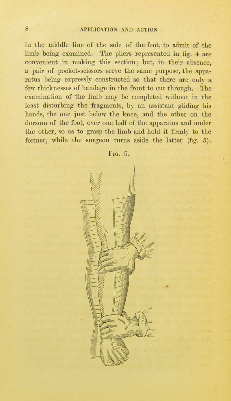 in the middle line of the sole of the foot, to admit of the limb being examined. The pbers represented in fig. 4 are convenient in making this section; but, in their absence, a pair of pocket-scissors serve the same purpose, the appa- ratus being expressly constructed so that there are only a few thicknesses of bandage in the front to cut through. The examination of the limb may be completed without in the least disturbing the fragments, by an assistant gliding his hands, the one just below the knee, and the other on the dorsum of the foot, over one half of the apparatus and under the other, so as to grasp the limb and hold it firmly to the former, while the surgeon turns aside the latter (fig. 5).