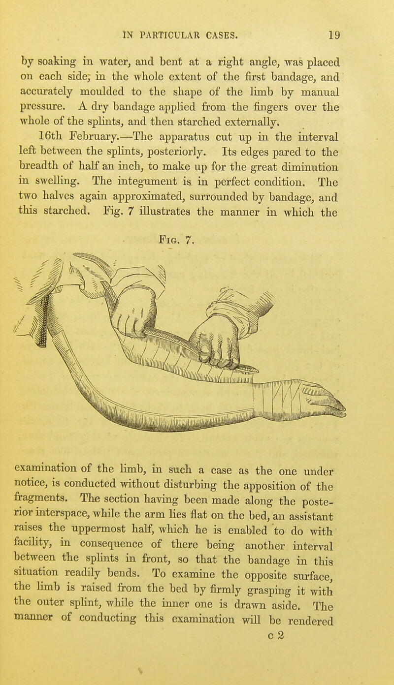 by soaking in water, and bent at a right angle, was placed on each side; in the whole extent of the first bandage, and accurately moulded to the shape of the limb by manual pressure. A dry bandage applied from the fingers over the whole of the splints, and then starched externally. 16th February.—The apparatus cut up in the interval left between the splints, posteriorly. Its edges pared to the breadth of half an inch, to make up for the great diminution in swelling. The integument is in perfect condition. The two halves again approximated, surrounded by bandage, and this starched. Fig. 7 illustrates the manner in which the Pig. 7. examination of the limb, in such a case as the one under notice, is conducted without disturbing the apposition of the fragments. The section having been made along the poste- rior interspace, while the arm lies flat on the bed, an assistant raises the uppermost half, which he is enabled to do with facility, in consequence of there being another interval between the splints in front, so that the bandage in this situation readily bends. To examine the opposite surface, the limb is raised from the bed by firmly grasping it with the outer splint, while the inner one is drawn aside. The manner of conducting this examination will be rendered c 2