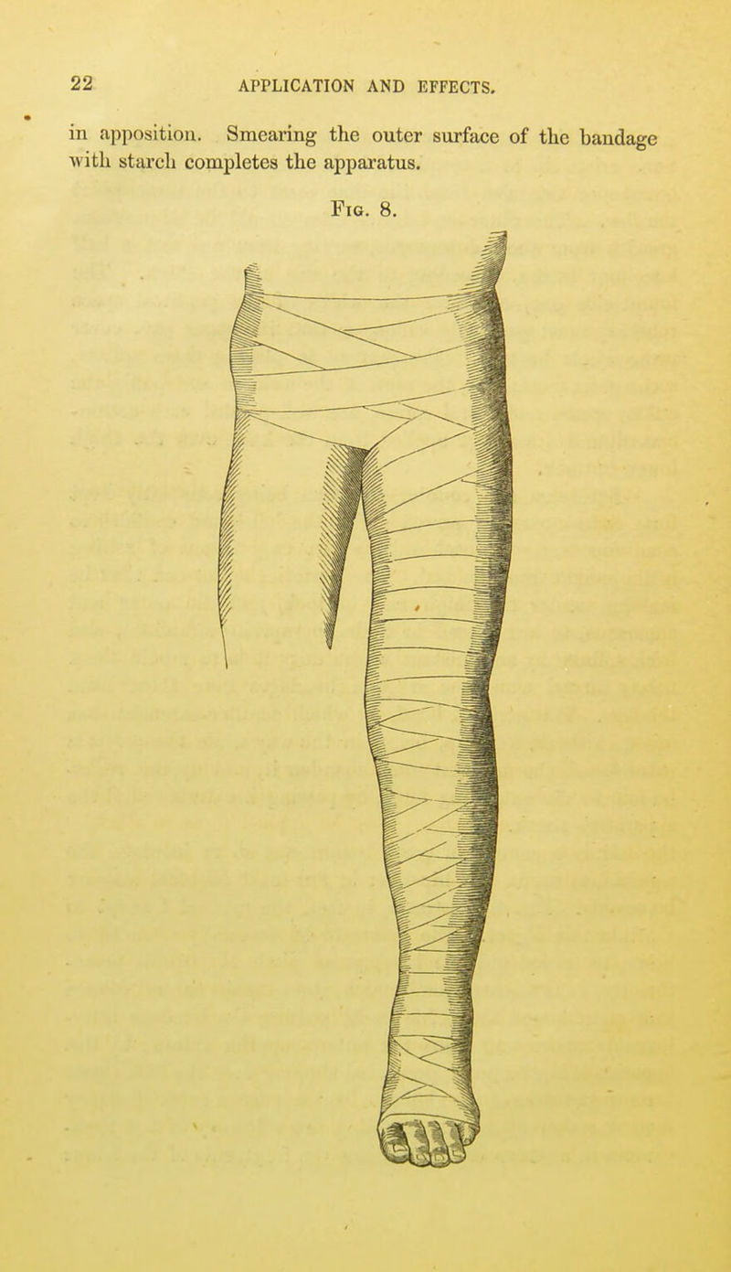 in apposition. Smearing the outer surface of the baudage with starch completes the apparatus. Fig. 8.