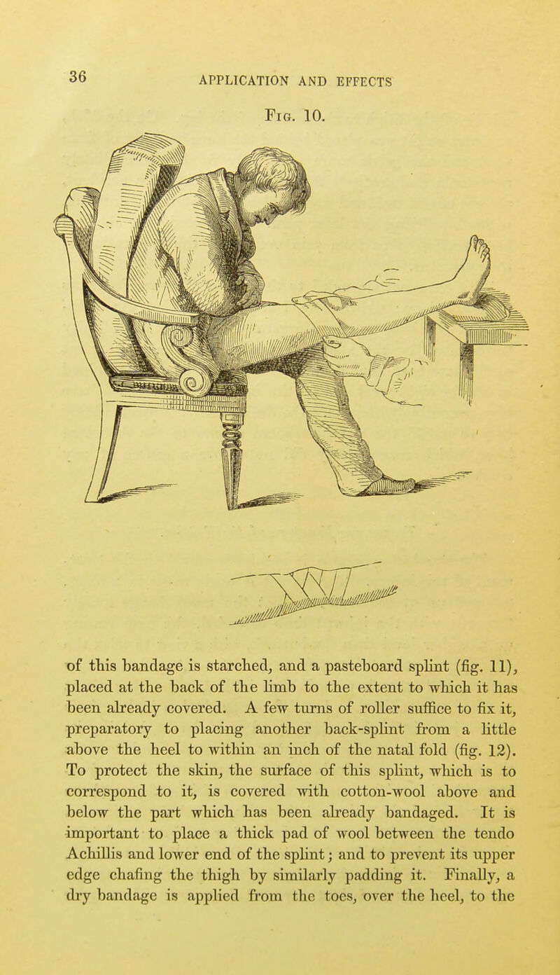 Fig. 10. of this bandage is starched, and a pasteboard splint (fig. 11), placed at the back of the limb to the extent to which it has been already covered. A few turns of roller suffice to fix it, preparatory to placing another back-splint from a little above the heel to within an inch of the natal fold (fig. 12). To protect the skin, the surface of this splint, which is to correspond to it, is covered with cotton-wool above and below the part which has been already bandaged. It is important to place a thick pad of wool between the tendo Achillis and lower end of the splint; and to prevent its upper edge chafing the thigh by similarly padding it. Finally, a dry bandage is applied from the toes, over the heel, to the