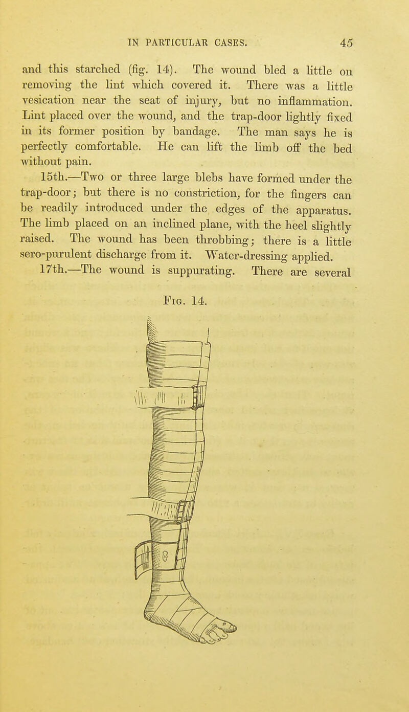 and this starched (fig. 14). The wound bled a little on removing the lint which covered it. There was a little vesication near the seat of injury, but no inflammation. Lint placed over the wound, and the trap-door lightly fixed in its former position by bandage. The man says he is perfectly comfortable. He can lift the limb off the bed without pain. 15th.—Two or three large blebs have formed under the trap-door; but there is no constriction, for the fingers can be readily introduced under the edges of the apparatus. The limb placed on an inclined plane, with the heel slightly raised. The wound has been throbbing; there is a little sero-purulent discharge from it. Water-dressing applied. 17th.—The wound is suppurating. There are several Fig. 14.