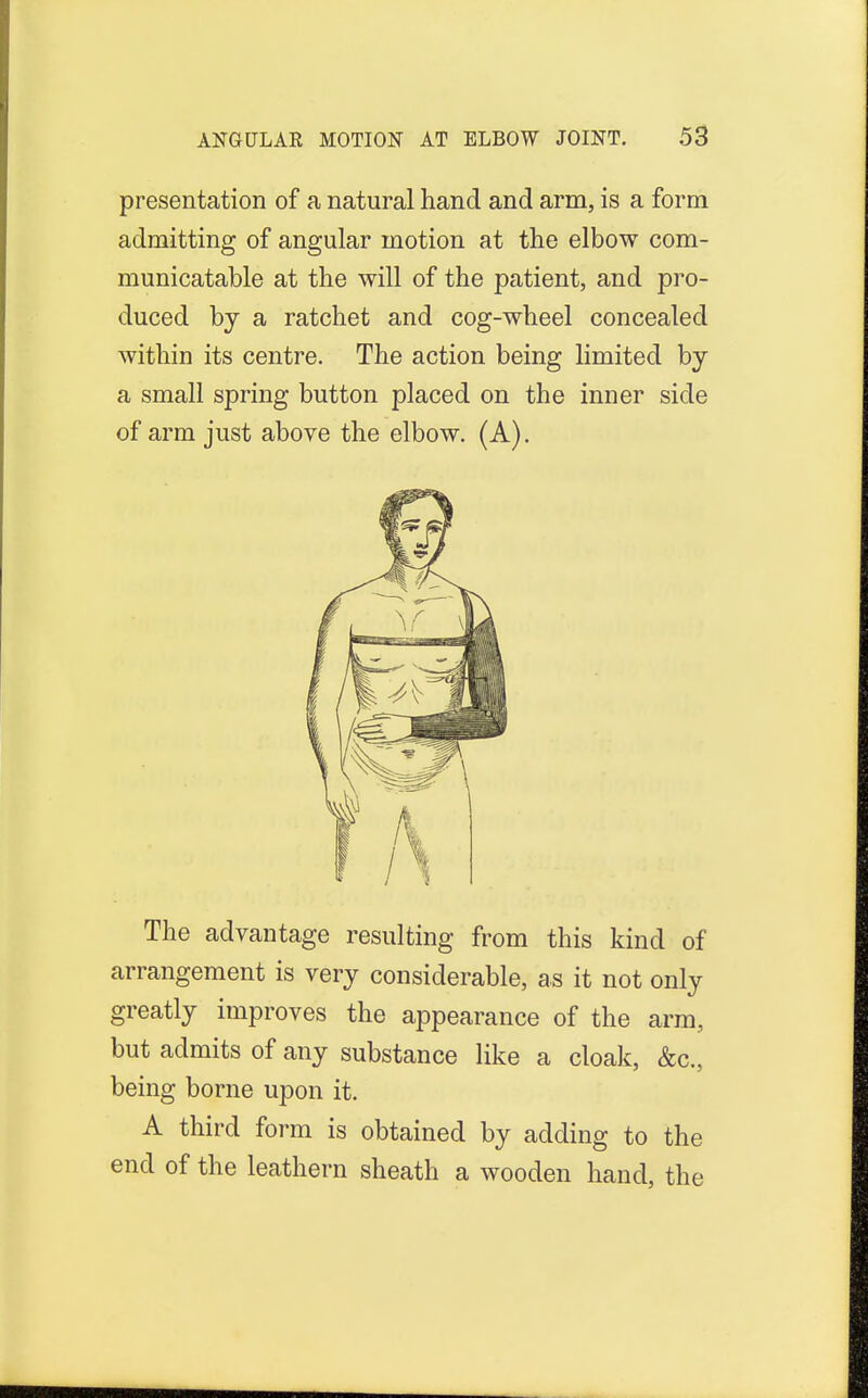presentation of a natural hand and arm, is a form admitting of angular motion at the elbow com- municatable at the will of the patient, and pro- duced by a ratchet and cog-wheel concealed within its centre. The action being limited by a small spring button placed on the inner side of arm just above the elbow. (A). The advantage resulting from this kind of arrangement is very considerable, as it not only greatly improves the appearance of the arm, but admits of any substance like a cloak, &c, being borne upon it. A third form is obtained by adding to the end of the leathern sheath a wooden hand, the
