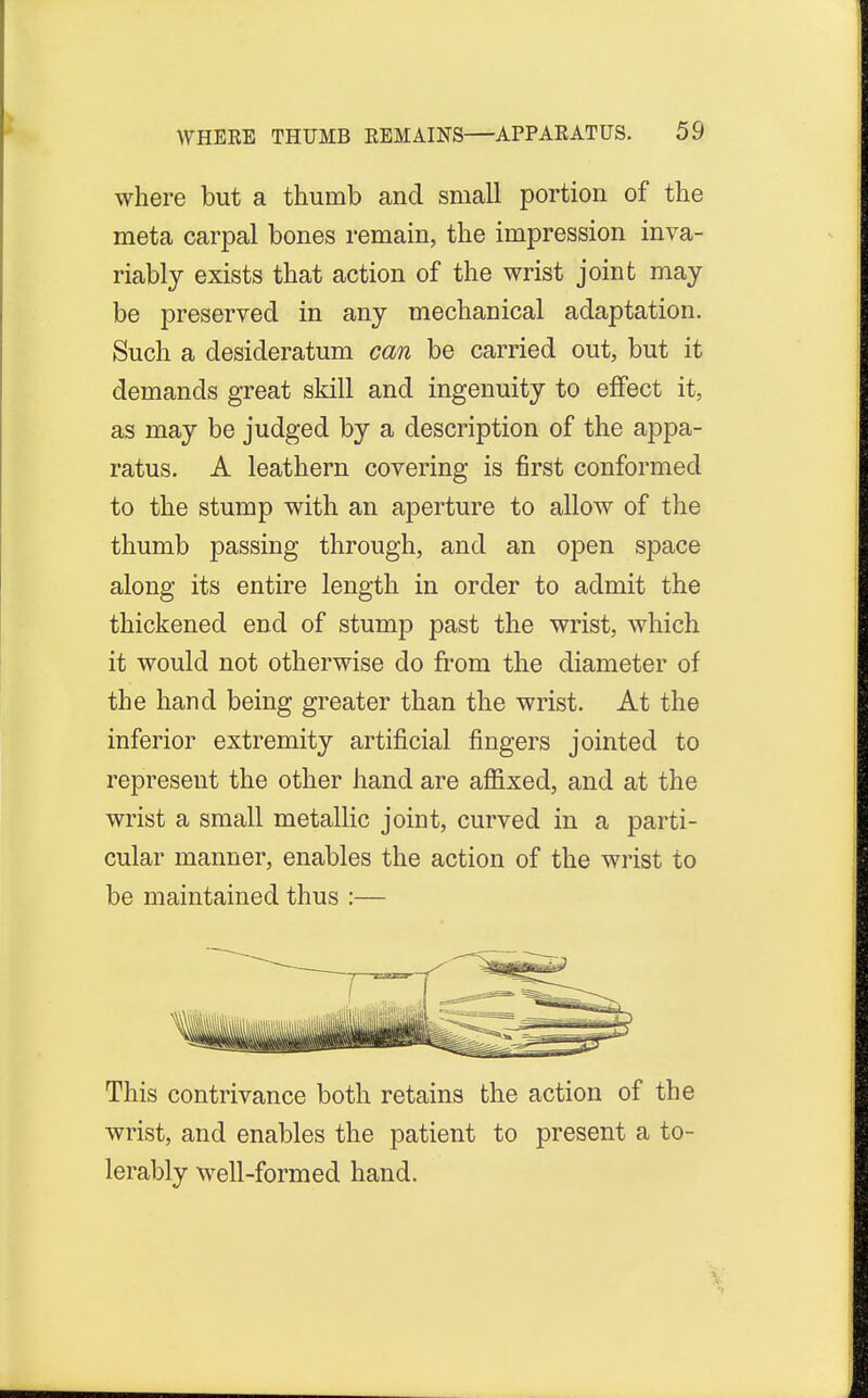 where but a thumb and small portion of the meta carpal bones remain, the impression inva- riably exists that action of the wrist joint may be preserved in any mechanical adaptation. Such a desideratum can be carried out, but it demands great skill and ingenuity to effect it, as may be judged by a description of the appa- ratus. A leathern covering is first conformed to the stump with an aperture to allow of the thumb passing through, and an open space along its entire length in order to admit the thickened end of stump past the wrist, which it would not otherwise do from the diameter of the hand being greater than the wrist. At the inferior extremity artificial fingers jointed to represent the other hand are affixed, and at the wrist a small metallic joint, curved in a parti- cular manner, enables the action of the wrist to be maintained thus :— This contrivance both retains the action of the wrist, and enables the patient to present a to- lerably well-formed hand.