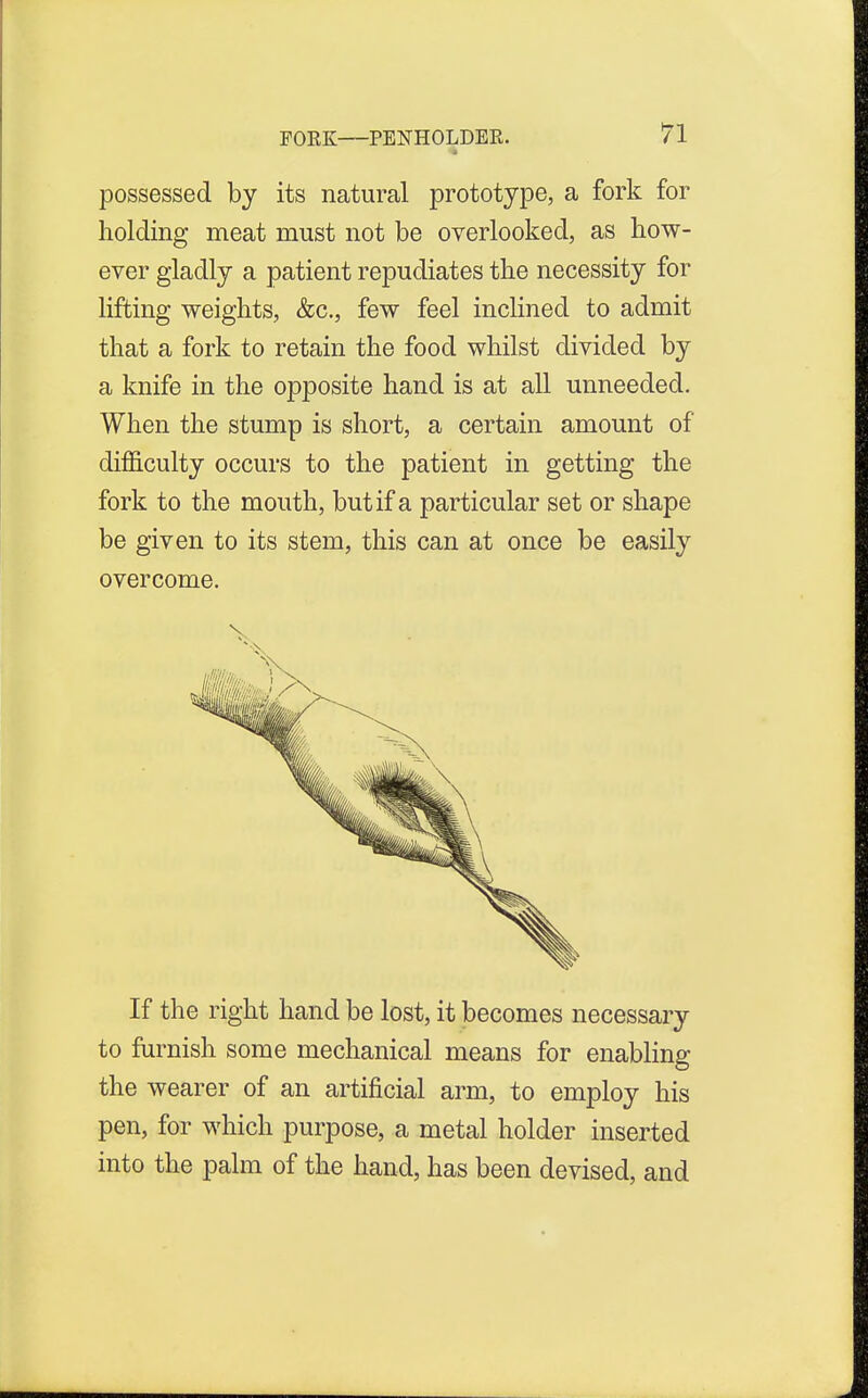 possessed by its natural prototype, a fork for holding meat must not be overlooked, as how- ever gladly a patient repudiates the necessity for lifting weights, &c, few feel inclined to admit that a fork to retain the food whilst divided by a knife in the opposite hand is at all unneeded. When the stump is short, a certain amount of difficulty occurs to the patient in getting the fork to the mouth, but if a particular set or shape be given to its stem, this can at once be easily overcome. If the right hand be lost, it becomes necessary to furnish some mechanical means for enabling the wearer of an artificial arm, to employ his pen, for which purpose, a metal holder inserted into the palm of the hand, has been devised, and