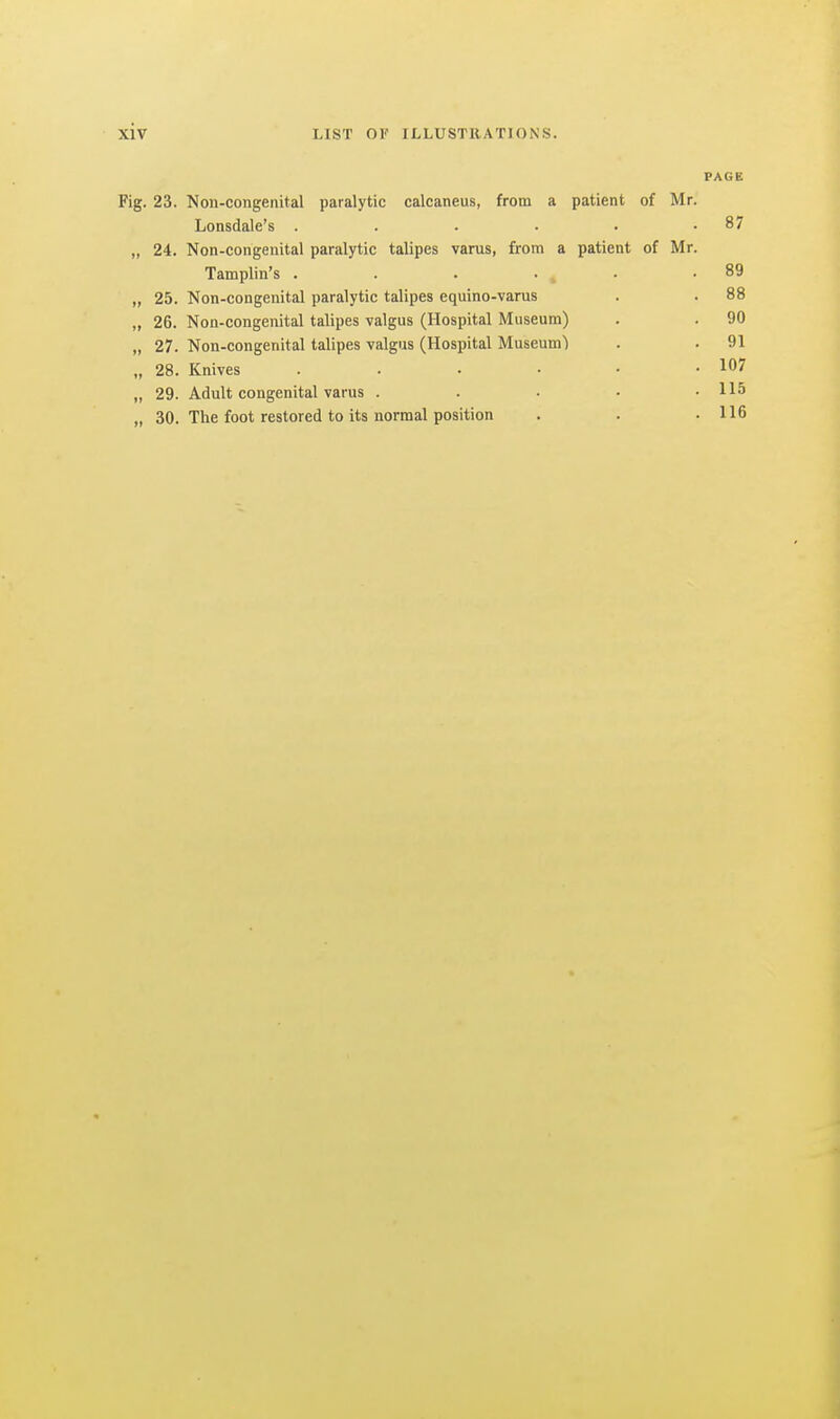 PAGE Fig. 23. Non-congenital paralytic calcaneus, from a patient of Mr. Lonsdale's .... . 87 „ 24. Non-congenital paralytic talipes varus, from a patient of Mr. Tamplin's .... . 89 „ 25. Non-congenital paralytic talipes equino-varus . 88 „ 26. Non-congenital talipes valgus (Hospital Museum) . 90 „ 27. Non-congenital talipes valgus (Hospital Museum') . 91 „ 28. Knives .... . 107 „ 29. Adult congenital varus . . 115 „ 30. The foot restored to its normal position . 116