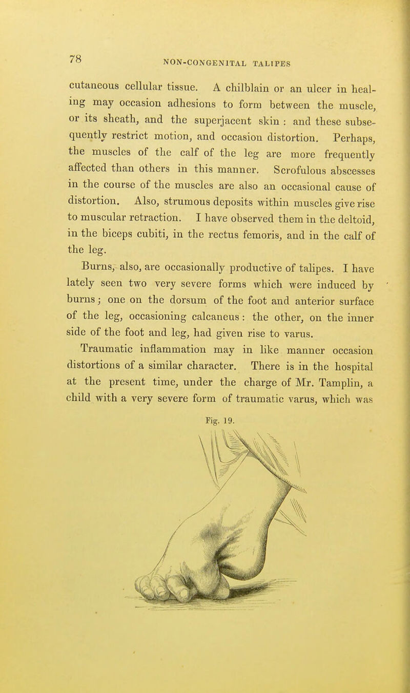 NON-CONGENITAL TALIPES cutaneous cellular tissue. A chilblain or an ulcer in heal- ing may occasion adhesions to form between the muscle, or its sheath, and the superjacent skin : and these subse- quently restrict motion, and occasion distortion. Perhaps, the muscles of the calf of the leg are more frequently affected than others in this manner. Scrofulous abscesses in the course of the muscles are also an occasional cause of distortion. Also, strumous deposits within muscles give rise to muscular retraction. I have observed them in the deltoid, in the biceps cubiti, in the rectus femoris, and in the calf of the leg. Burns, also, are occasionally productive of tahpes. I have lately seen two very severe forms which were induced by burns; one on the dorsum of the foot and anterior surface of the leg, occasioning calcaneus : the other, on the inner side of the foot and leg, had given rise to varus. Traumatic inflammation may in like manner occasion distortions of a similar character. There is in the hospital at the present time, under the charge of Mr. Tamplin, a child with a very severe form of traumatic varus, which was