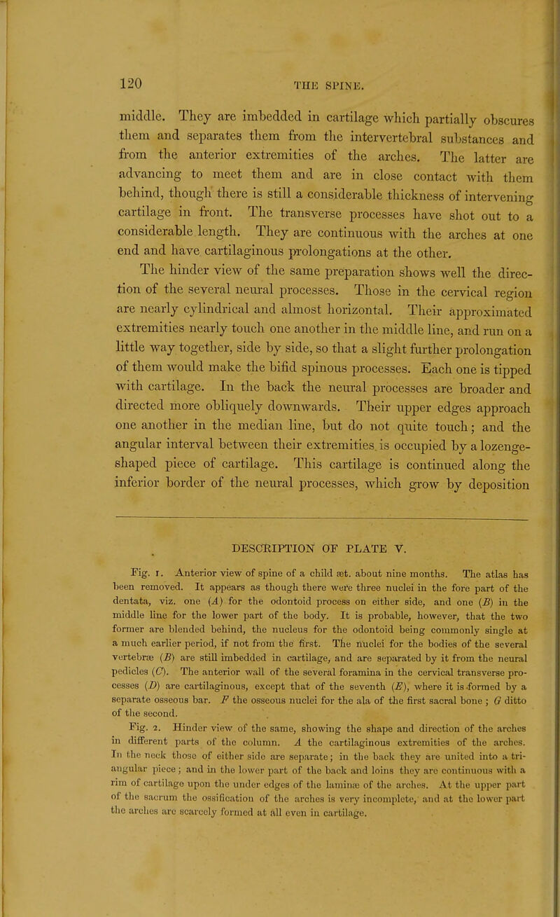 middle. They are imbedded in cartilage wliicli partially obscures them and separates them from the intervertebral substances and from the anterior extremities of the arches. The latter are advancing to meet them and are in close contact with them behind, though there is still a considerable thickness of intervening cartilage in front. The transverse processes have shot out to a considerable length. They are continuous with the arches at one end and have cartilaginous p-olongations at the other. The hinder view of the same preparation shows well the direc- tion of the several nem-al processes. Those in the cervical region are nearly cylindrical and almost horizontal. Their approximated extremities nearly touch one another in the middle line, and run on a little way together, side by side, so that a slight further prolongation of them would make the bifid spinous processes. Each one is tipped with cartilage. In the back the neural processes are broader and directed more obliquely downwards. Their upper edges approach one another in the median line, but d-o not quite touch; and the angular interval between their extremities, is occupied by a lozenge- shaped piece of cartilage. This cartilage is continued along the inferior border of the neural processes, which grow by deposition DESCEIPTION OF PLATE V. Fig. r. Anterior view of spine of a child aBt. about nine months. The atlas has been removed. It appears as though there were three nuclei in the fore part of the dentata, viz. one (A) for the odontoid process on either side, and one (B) in the middle line for the lower part of the body. It is probable, however, that the two former are blended behind, the nucleus for the odontoid being commonly single at a much earlier period, if not from the first. The nuclei for the bodies of the several vertebrte (B) are still imbedded in cartilage, and are separated by it from the neural pedicles ((7). The anterior wall of the several foramina in the cervical transverse pro- cesses (D) are cartilaginous, except that of the seventh (E), where it is -fomied by a separate osseous bar. F the osseous nuclei for the ala of the first sacral bone ; G ditto of the second. Fig. 2. Hinder view of the same, showing the shape and direction of the arches in difierent parts of the column. A the cartilaginous extremities of the arches. In the neck those of either side are separate; in the back they are united into a tri- angular piece; and in the lower part of the back and loins they are continuous with a rim of cartilage upon the under edges of the laminae of the arches. At the upper part of the sacrum the ossification of the arches is very incomplete, and at the lower part the arches arc scarcely formed at all even in cartilage.
