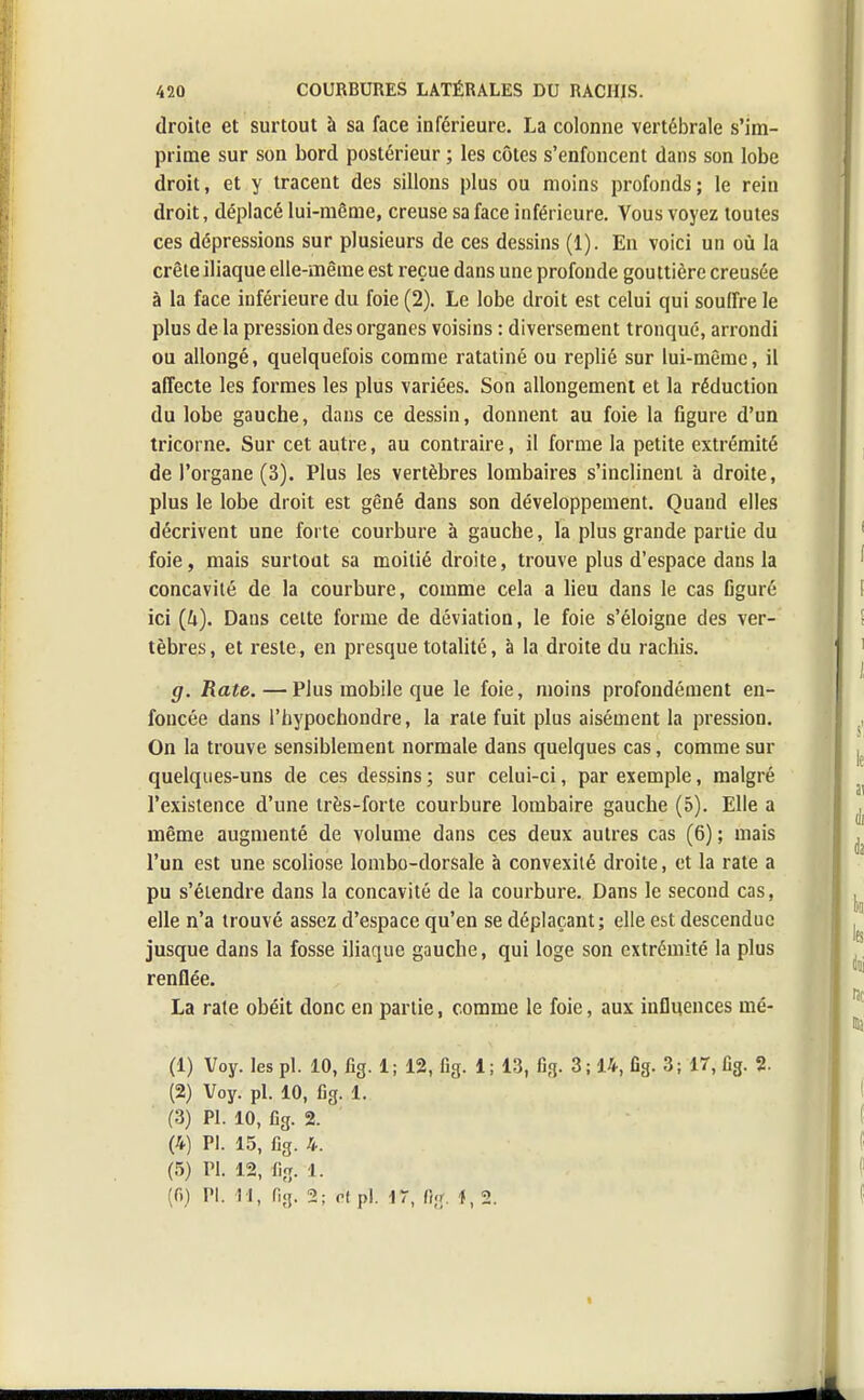 droite et surtout à sa face inférieure. La colonne vertébrale s'im- prime sur son bord postérieur ; les côtes s'enfoncent dans son lobe droit, et y tracent des sillons plus ou moins profonds; le rein droit, déplacé lui-même, creuse sa face inférieure. Vous voyez toutes ces dépressions sur plusieurs de ces dessins (1). En voici un où la crête iliaque elle-même est reçue dans une profonde gouttière creusée à la face inférieure du foie (2). Le lobe droit est celui qui souffre le plus de la pression des organes voisins : diversement tronqué, arrondi ou allongé, quelquefois comme ratatiné ou replié sur lui-même, il affecte les formes les plus variées. Son allongement et la réduction du lobe gauche, dans ce dessin, donnent au foie la figure d'un tricorne. Sur cet autre, au contraire, il forme la petite extrémité de l'organe (3). Plus les vertèbres lombaires s'inclinent à droite, plus le lobe droit est gêné dans son développement. Quand elles décrivent une forte courbure à gauche, la plus grande partie du foie, mais surtout sa moitié droite, trouve plus d'espace dans la concavité de la courbure, comme cela a lieu dans le cas figuré ici (4). Dans celte forme de déviation, le foie s'éloigne des ver- tèbres , et reste, en presque totalité, à la droite du rachis. g. Rate.—Plus mobile que le foie, moins profondément en- foncée dans Phypochondre, la rate fuit plus aisément la pression. On la trouve sensiblement normale dans quelques cas, comme sur quelques-uns de ces dessins ; sur celui-ci, par exemple, malgré l'existence d'une très-forte courbure lombaire gauche (5). Elle a même augmenté de volume dans ces deux autres cas (6) ; mais l'un est une scoliose lombo-dorsale à convexité droite, et la rate a pu s'étendre dans la concavité de la courbure. Dans le second cas, elle n'a trouvé assez d'espace qu'en se déplaçant; elle est descendue jusque dans la fosse iliaque gauche, qui loge son extrémité la plus renflée. La rate obéit donc en partie, comme le foie, aux influences mé- (1) Voy. les pl. 10, fig. 1; 12, fig. i; 13, fig. 3; 14, fig. 3; 17, fig. % (2) Voy. pl. 10, fig. 1. (3) Pl. 10, fig. 2. (4) Pl. 15, fig. 4. (5) Pl. 12, fig. 1. (fi) Pl. I l, fig. 2; rf pl. 17, fî;r. |, 2. 1