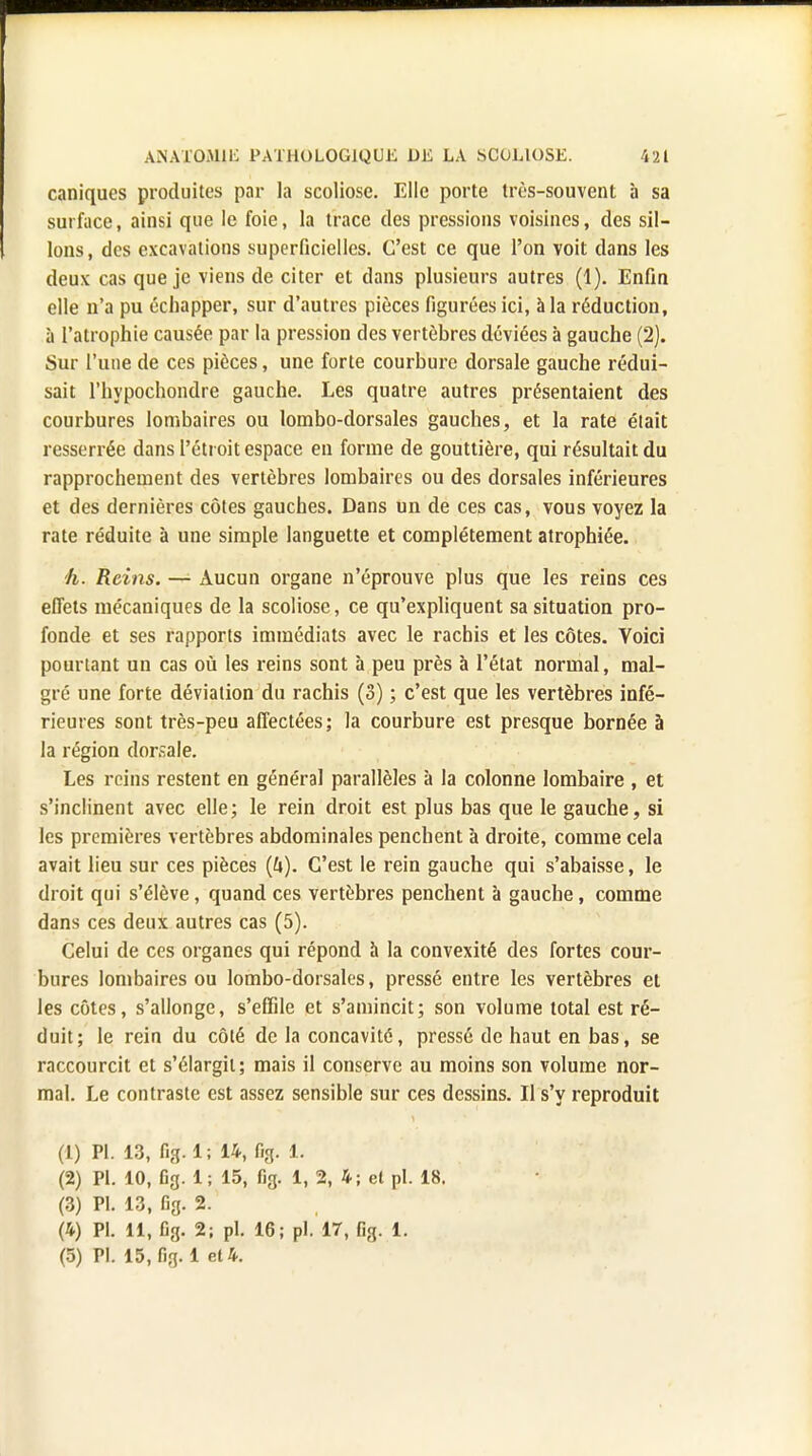 caniques produites par la scoliose. Elle porte très-souvent à sa surface, ainsi que le foie, la trace des pressions voisines, des sil- lons, des excavations superficielles. C'est ce que l'on voit dans les deux cas que je viens de citer et dans plusieurs autres (1). Enfin elle n'a pu échapper, sur d'autres pièces figurées ici, à la réduction, à l'atrophie causée par la pression des vertèbres déviées à gauche (2). Sur l'une de ces pièces, une forte courbure dorsale gauche rédui- sait l'hypochondre gauche. Les quatre autres présentaient des courbures lombaires ou lombo-dorsales gauches, et la rate était resserrée dans l'étroit espace en forme de gouttière, qui résultait du rapprochement des vertèbres lombaires ou des dorsales inférieures et des dernières côtes gauches. Dans un de ces cas, vous voyez la rate réduite à une simple languette et complètement atrophiée. h. Reins. — Aucun organe n'éprouve plus que les reins ces effets mécaniques de la scoliose, ce qu'expliquent sa situation pro- fonde et ses rapports immédiats avec le rachis et les côtes. Voici pourtant un cas où les reins sont à peu près à l'état normal, mal- gré une forte déviation du rachis (3) ; c'est que les vertèbres infé- rieures sont très-peu affectées; la courbure est presque bornée à la région dorsale. Les reins restent en général parallèles à la colonne lombaire , et s'inclinent avec elle; le rein droit est plus bas que le gauche, si les premières vertèbres abdominales penchent à droite, comme cela avait lieu sur ces pièces (ft). C'est le rein gauche qui s'abaisse, le droit qui s'élève, quand ces vertèbres penchent à gauche, comme dans ces deux autres cas (5). Celui de ces organes qui répond à la convexité des fortes cour- bures lombaires ou lombo-dorsales, pressé entre les vertèbres et les côtes, s'allonge, s'effile et s'amincit; son volume total est ré- duit; le rein du côté de la concavité, pressé de haut en bas, se raccourcit et s'élargit; mais il conserve au moins son volume nor- mal. Le contraste est assez sensible sur ces dessins. Il s'y reproduit (1) Pl. 13, fig. 1; 14, fig. 1. (2) Pl. 10, 6g. 1; 15, fig. 1, 2, 4; et pl. 18. (3) Pl. 13, fig. 2. (4) Pl. 11, fig. 2; pl. 16; pl. 17, fig. 1. (5) Pl. 15, fig. 1 et 4.