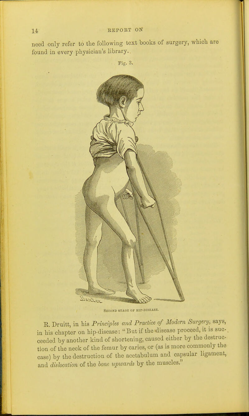 need only refer to the following text books of surgery, which are found in every physician's library. Fig. 3. Second stage of hip-disease. E. Druitt, in his Principles and Practice of Modern Surgery, says, in his chapter on hip-disease: But if the disease proceed, it is sue-, ceeded by another kind of shortening, caused either by the destruc- tion of the neck of the femur by caries, or (as is more commonly the case) by the destruction of the acetabulum and capsular ligament, and dislocation of the bone upwards by the muscles.