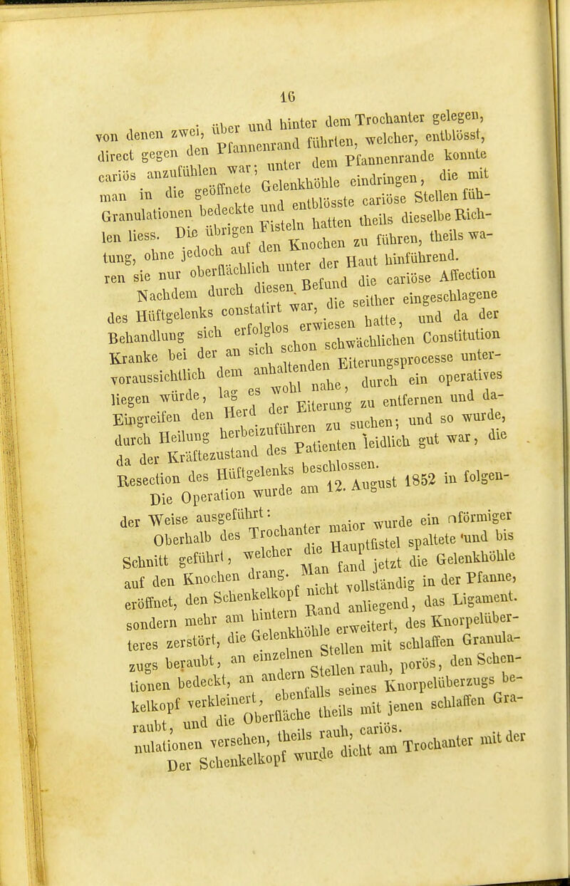 • -i« irail hinter dem Trochanter eelegen, ,o„ denen j^'' „™ „„^ mlir.en, welcher, entblUsst, direet S^S^Vf /tT ller dem Ptanenrande konnte cariös »»^f™/' tokhöMe eindringen, die mit man in die geöffnete enkhoM Grannlationen bedeckte ™^ entMo » aieseli>e Rich- 'en ^1^, tooh * mbren, theils «- tang, ohne »*, ^er Haut hinführend. xe„ sie nur oberHachl. h nnter der ^^^^^^^^^ Nachdem durch djesen^Befn^d desHlittgelenks constaU , Behandlung s,cU e ^^^^^ Coirstitutioir Kranke bei der an s A hon , „„ter- ^„raussichtUch dem ™to'™d^e^^^ ^^^^^ SeiÄ r ^«-rs:irt der Weise ausgeführt: nförmiger Oberhalb des Trocban er ma.or ^ „,4 schnitt getührl, welcher ^'^H ' GelenkhShle auf den Knochen f S-f n cht .ollstandig in der Pfanne, eröffnet, 1» Scbenkelkopf mcht , sondern mehr am hmlern » -^ Kuorpelttber- teres «rstort, G.^f'jf'g^^'^^rmit schlaffen Granula- ,„gs beraubt, an ^teHe, li^en bedeckt, an « ^ f j „„rpelüberzugs be- */^:rnUrr: ..je.enschla.cn Gra-